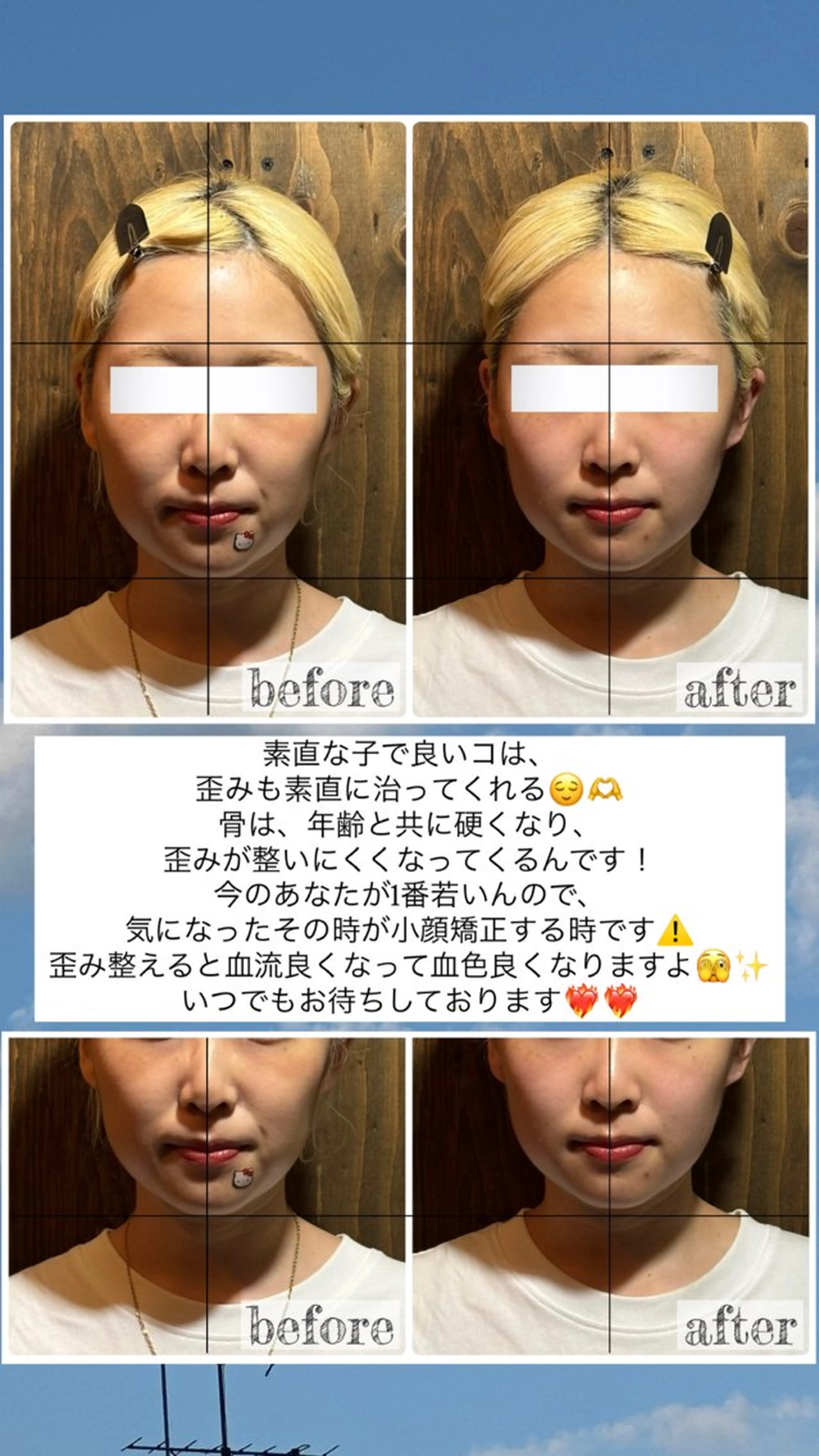 エステ リラク 💎後悔させない小顔 矯正💎イトヤマ🌱のエステ・リラクイメージ