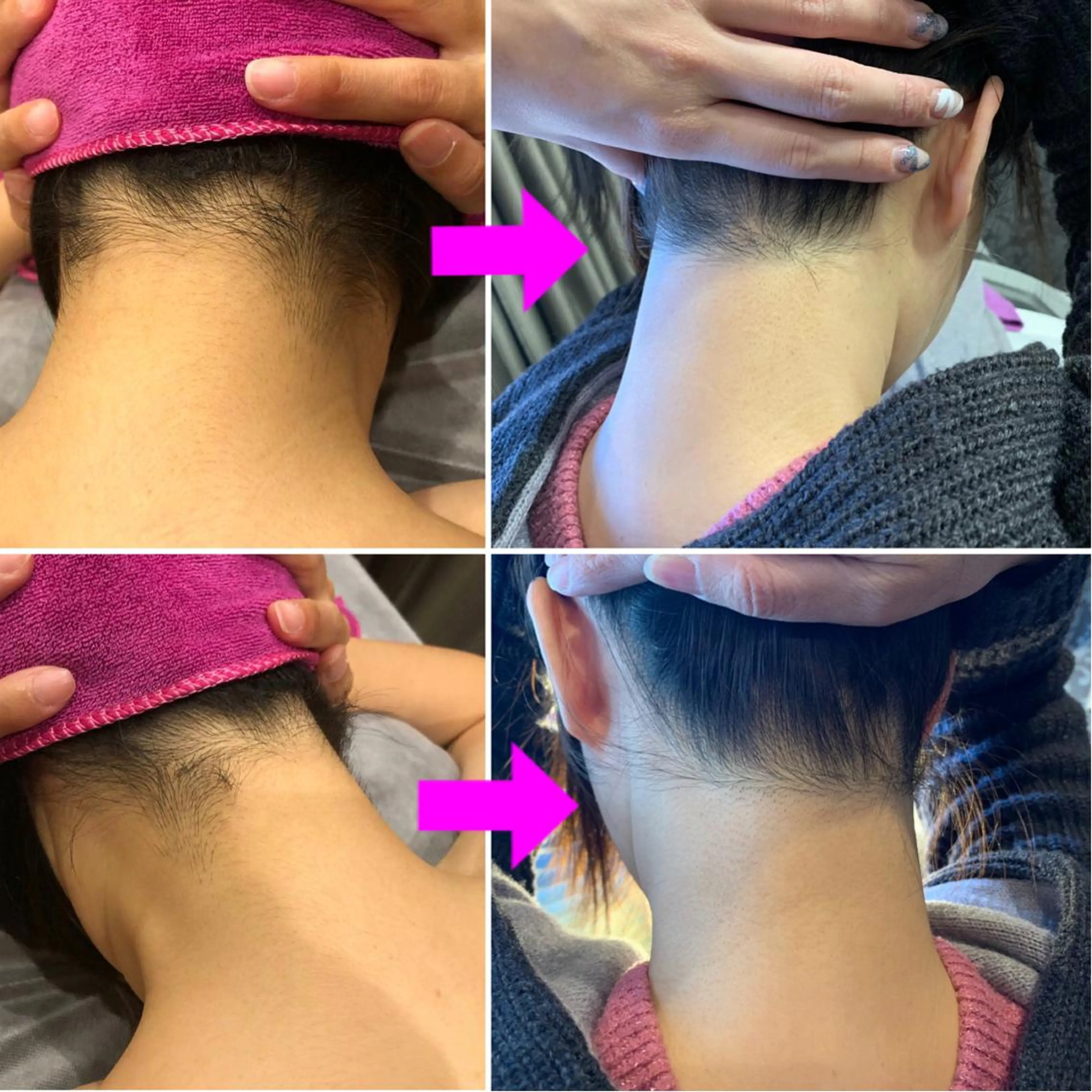 脱毛＆エステサロン【アンリミット】所属・森谷 莉美のエステ・リラクイメージ