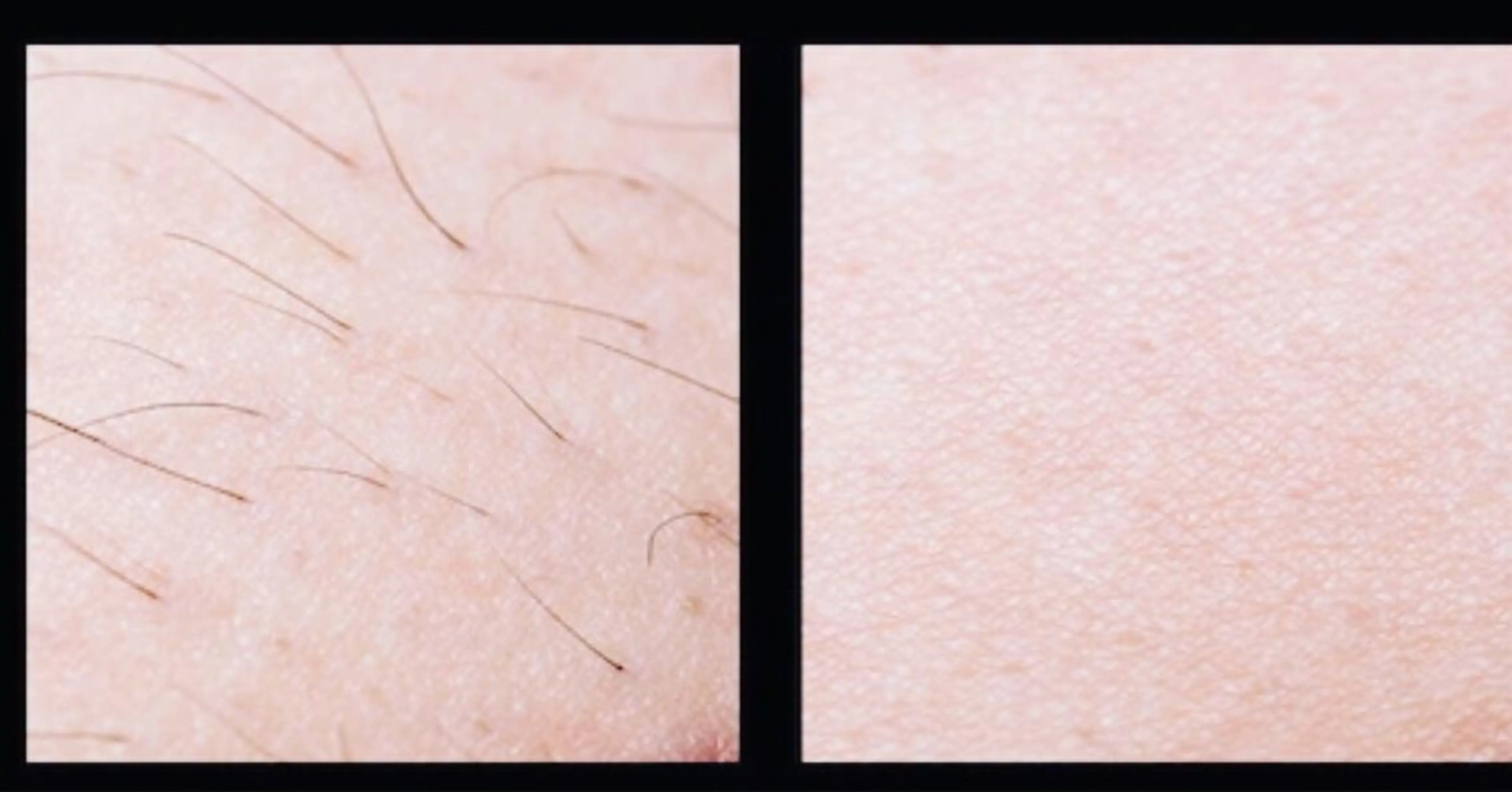 代表 MOMOのエステ・リラクイメージ