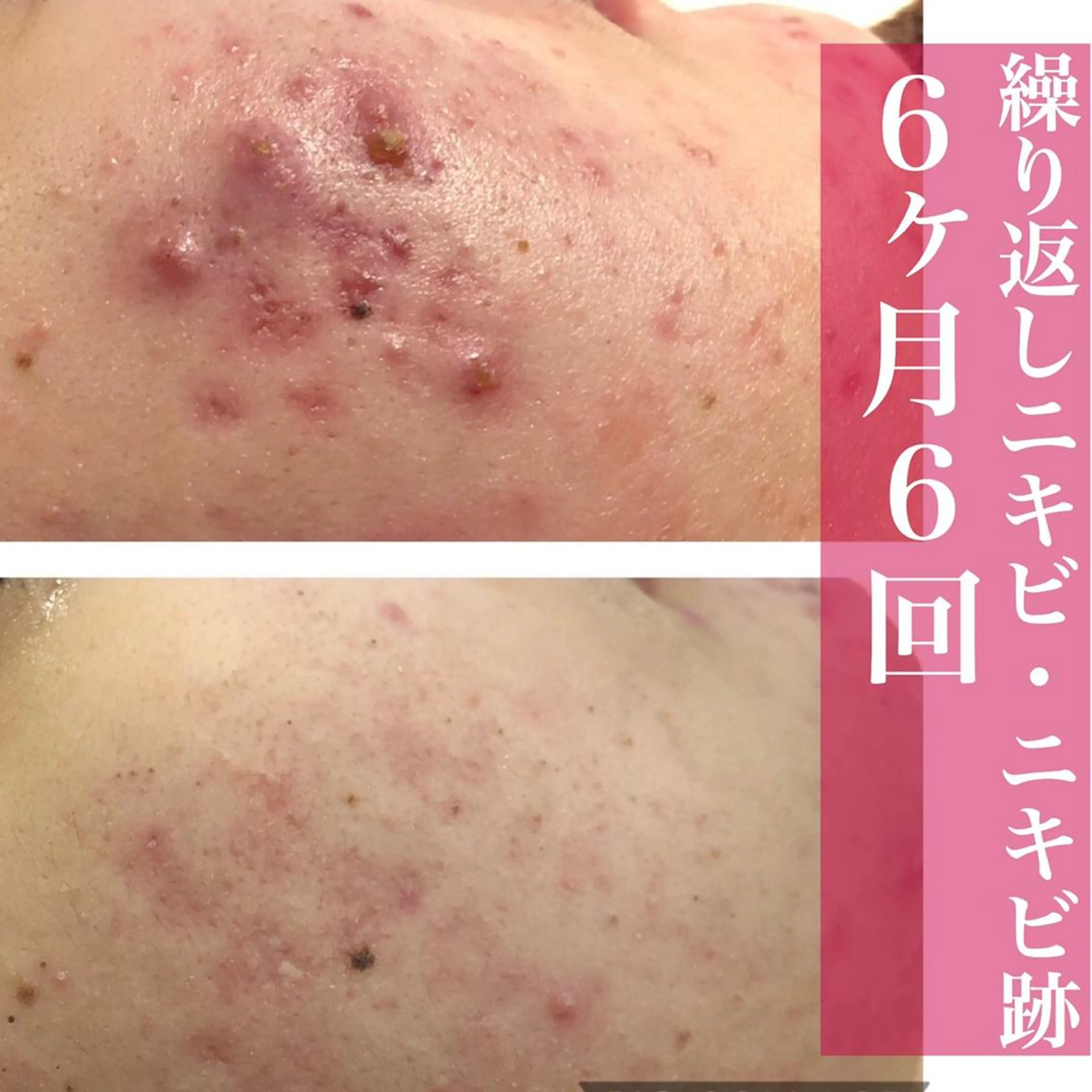 ミディアム カラー パーマ ヘアアレンジ メンズ キッズ ネイル マツエク・マツパ 赤色 ニキビ・肌質改善専門 ♡人生が変わるサロンのエステ・リラクイメージ