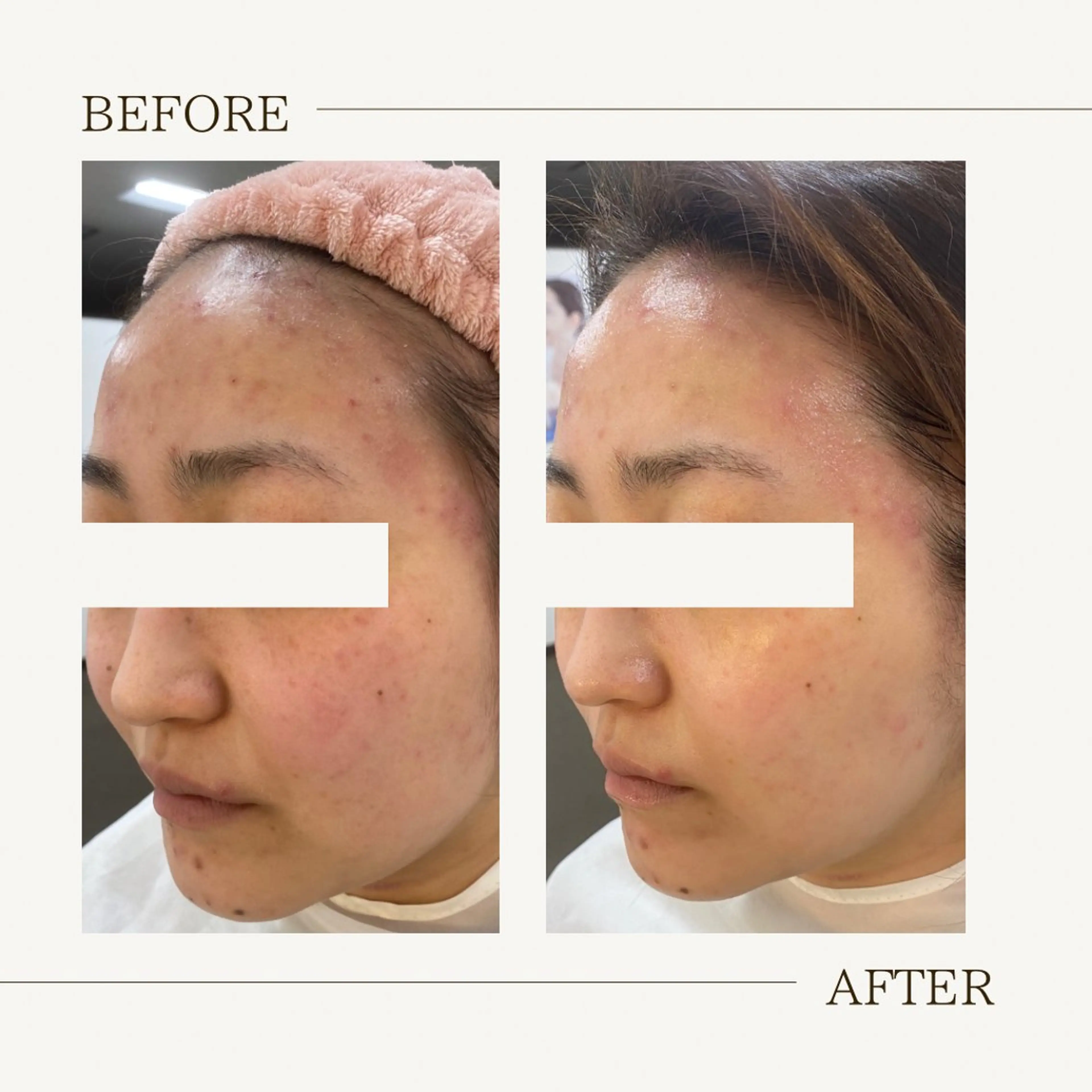 肌育成サロン ♡ RISAのエステ・リラクイメージ