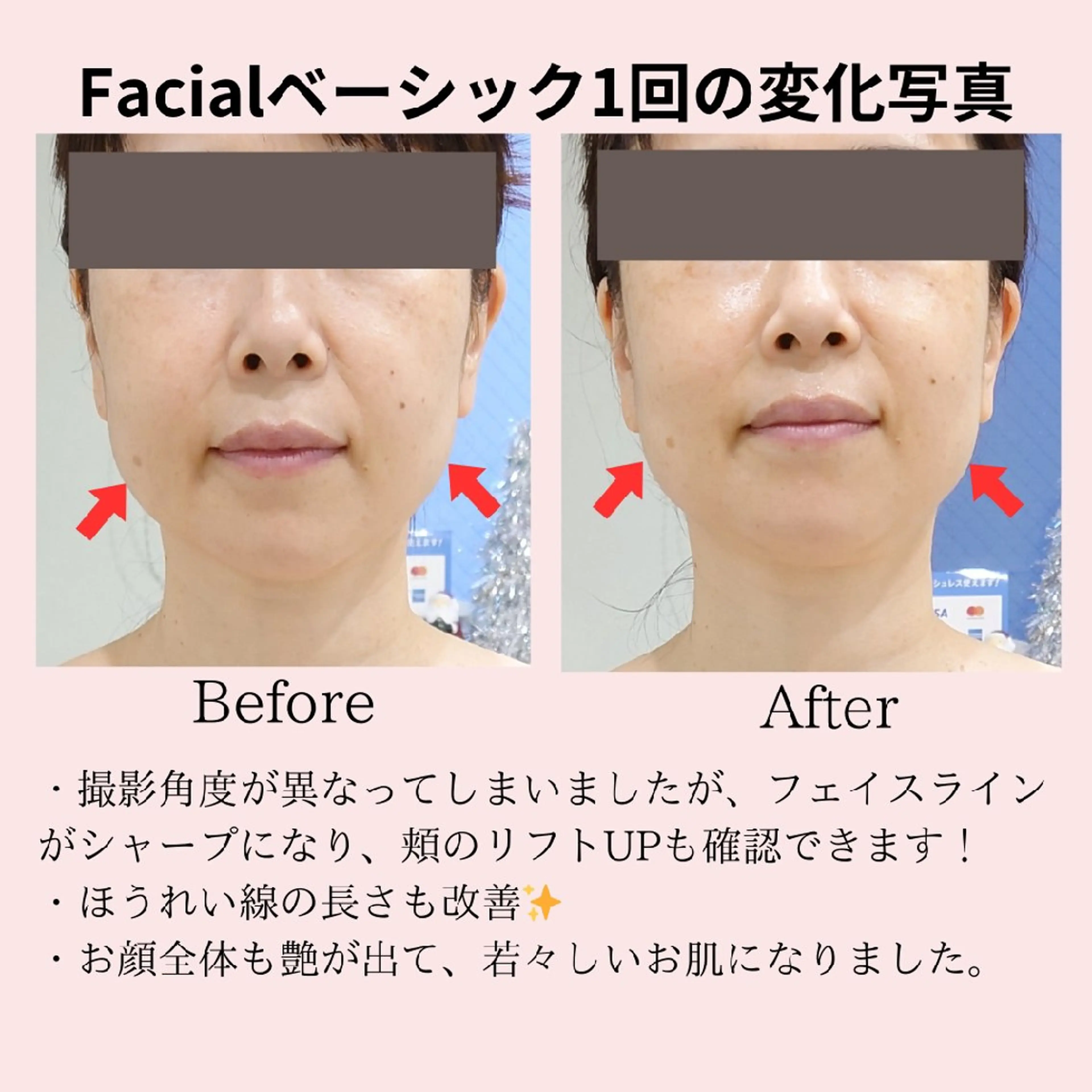 エステ フェイシャル/ボディ /ブライダル山田浩子のエステ・リラクイメージ