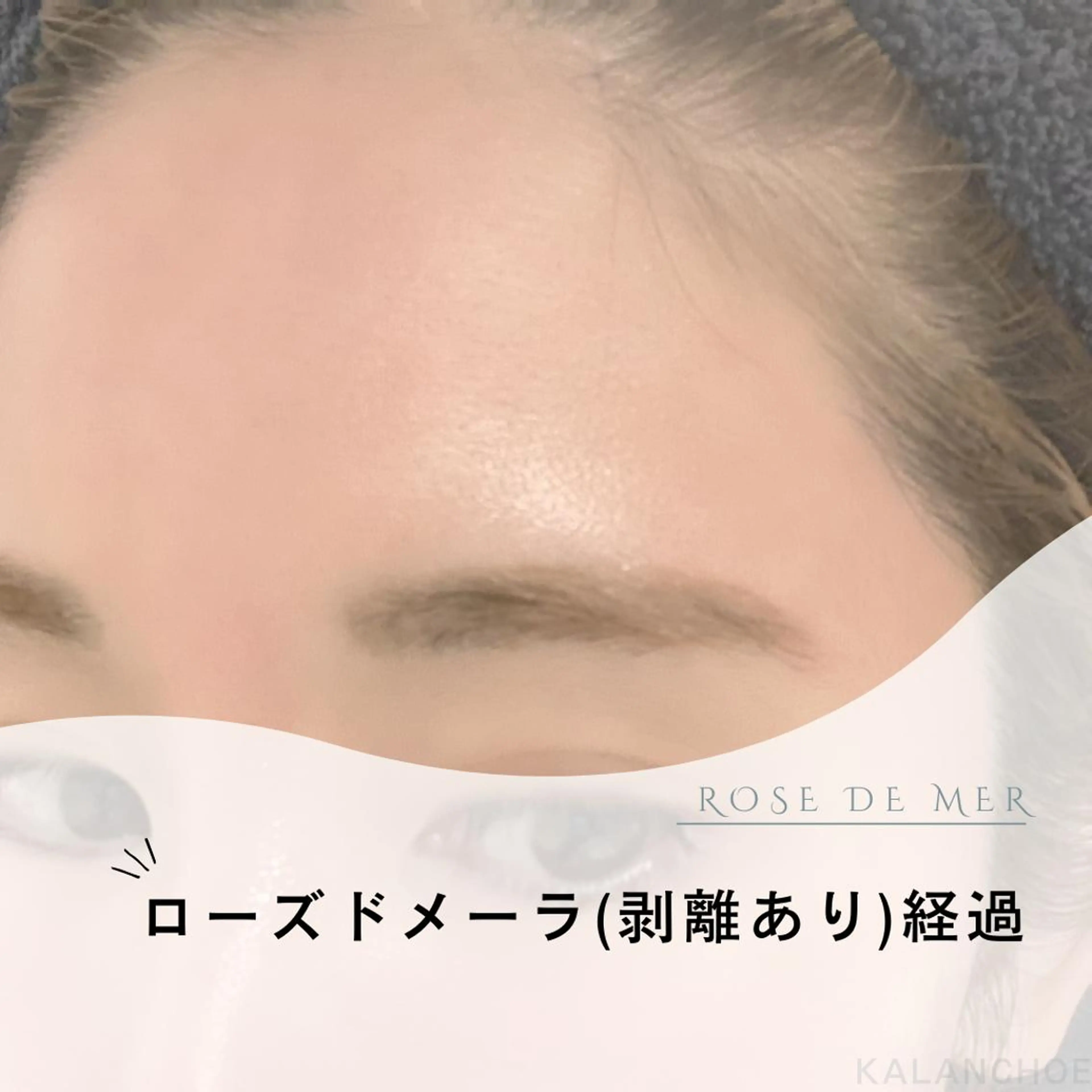 エステ 肌質改善 KALANCHOEのエステ・リラクイメージ