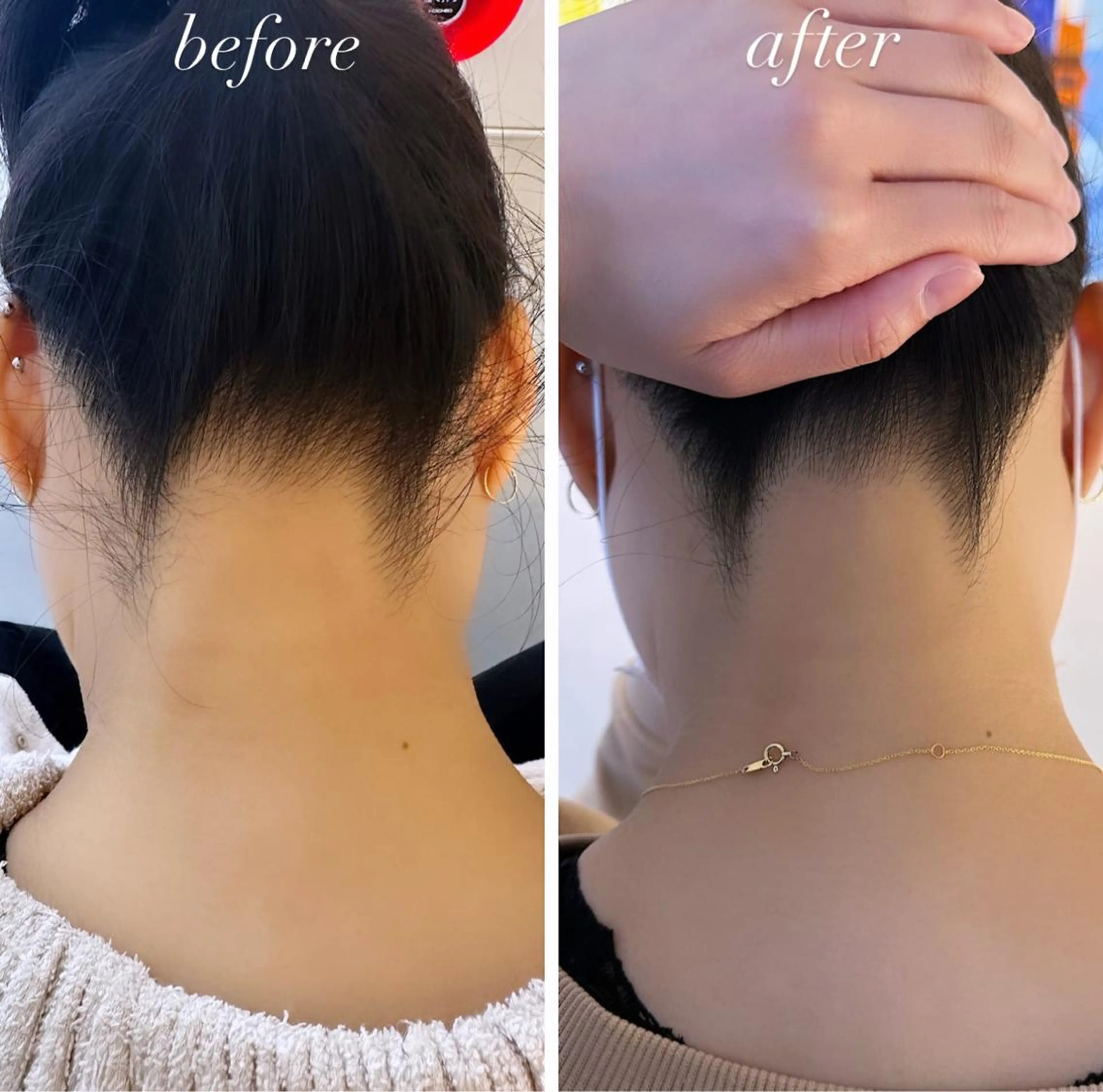 うなじ脱毛/美肌脱毛 LABELのエステ・リラクイメージ