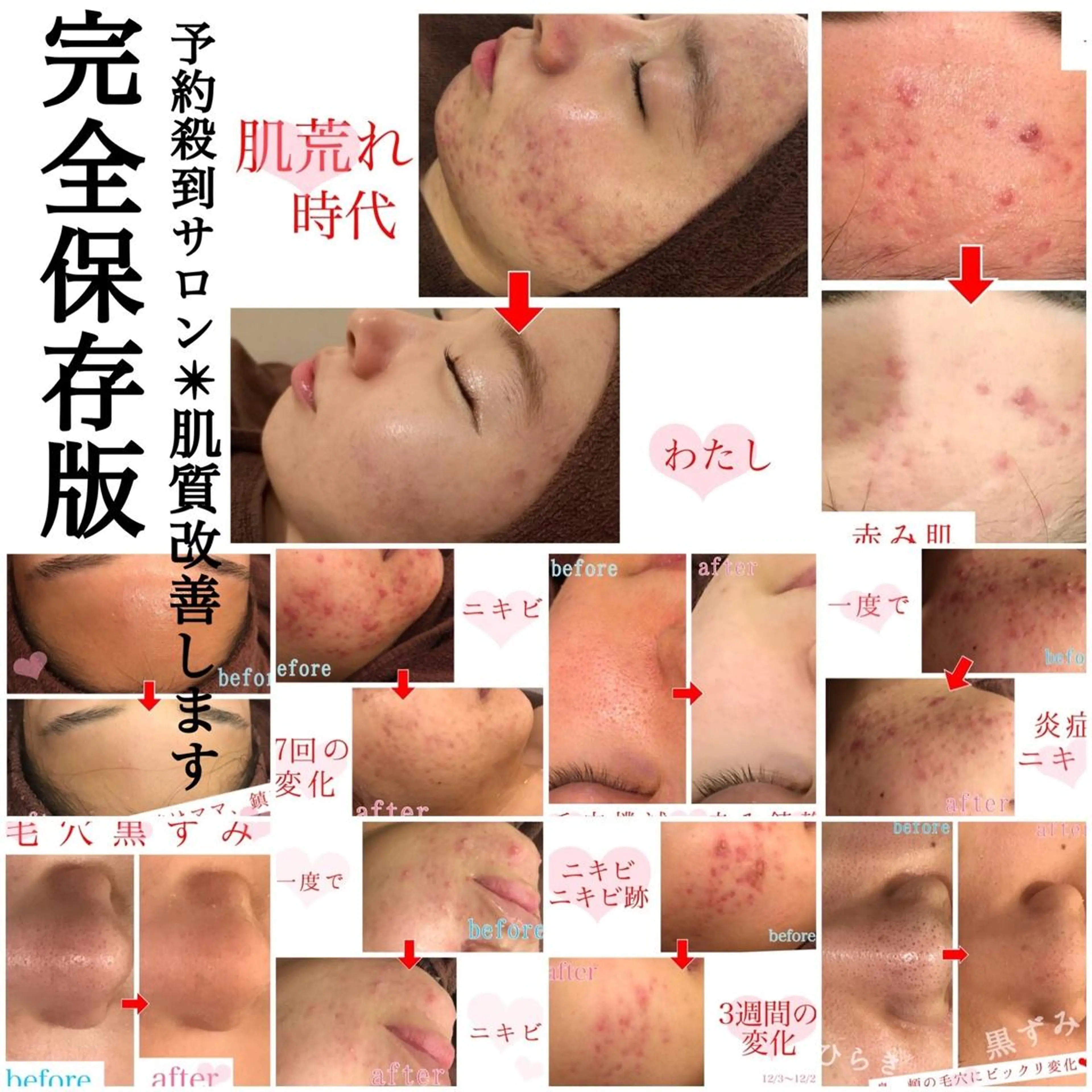 ミディアム カラー パーマ ヘアアレンジ メンズ キッズ ネイル マツエク・マツパ 金の糸脱毛 産毛ケア専門のエステ・リラクイメージ