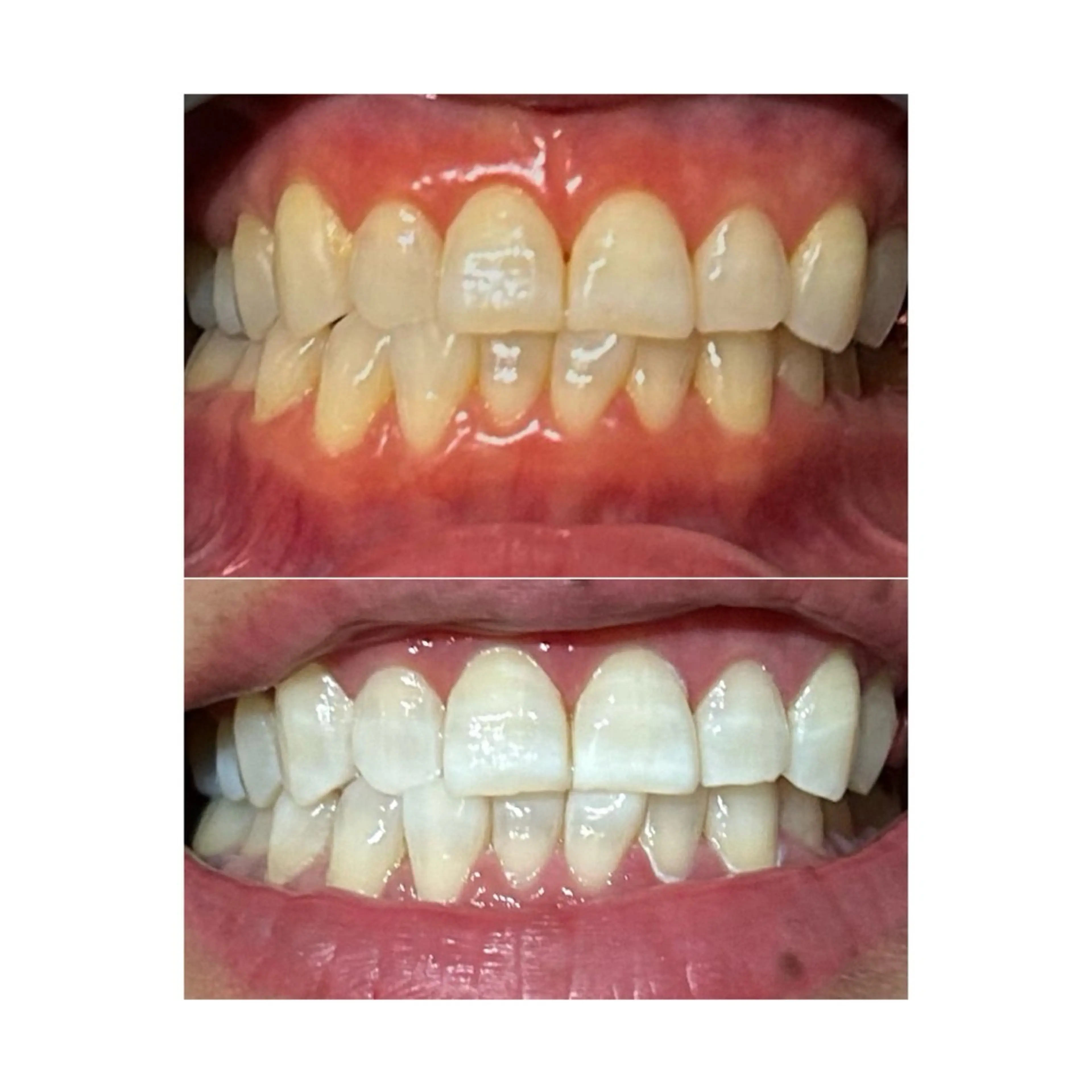 その他 ホワイトニングジム 池袋のその他イメージ