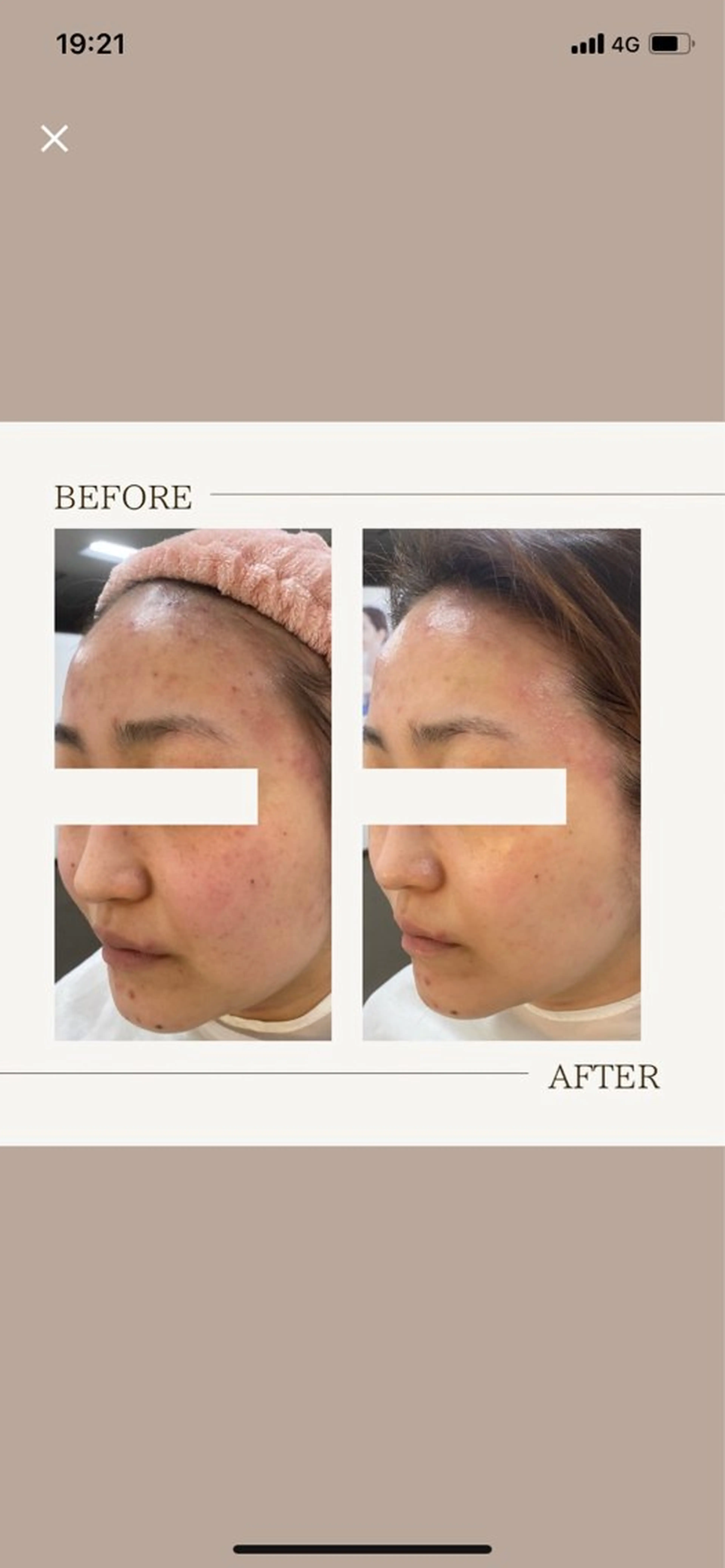 肌育成サロン ♡ RISAのエステ・リラクイメージ