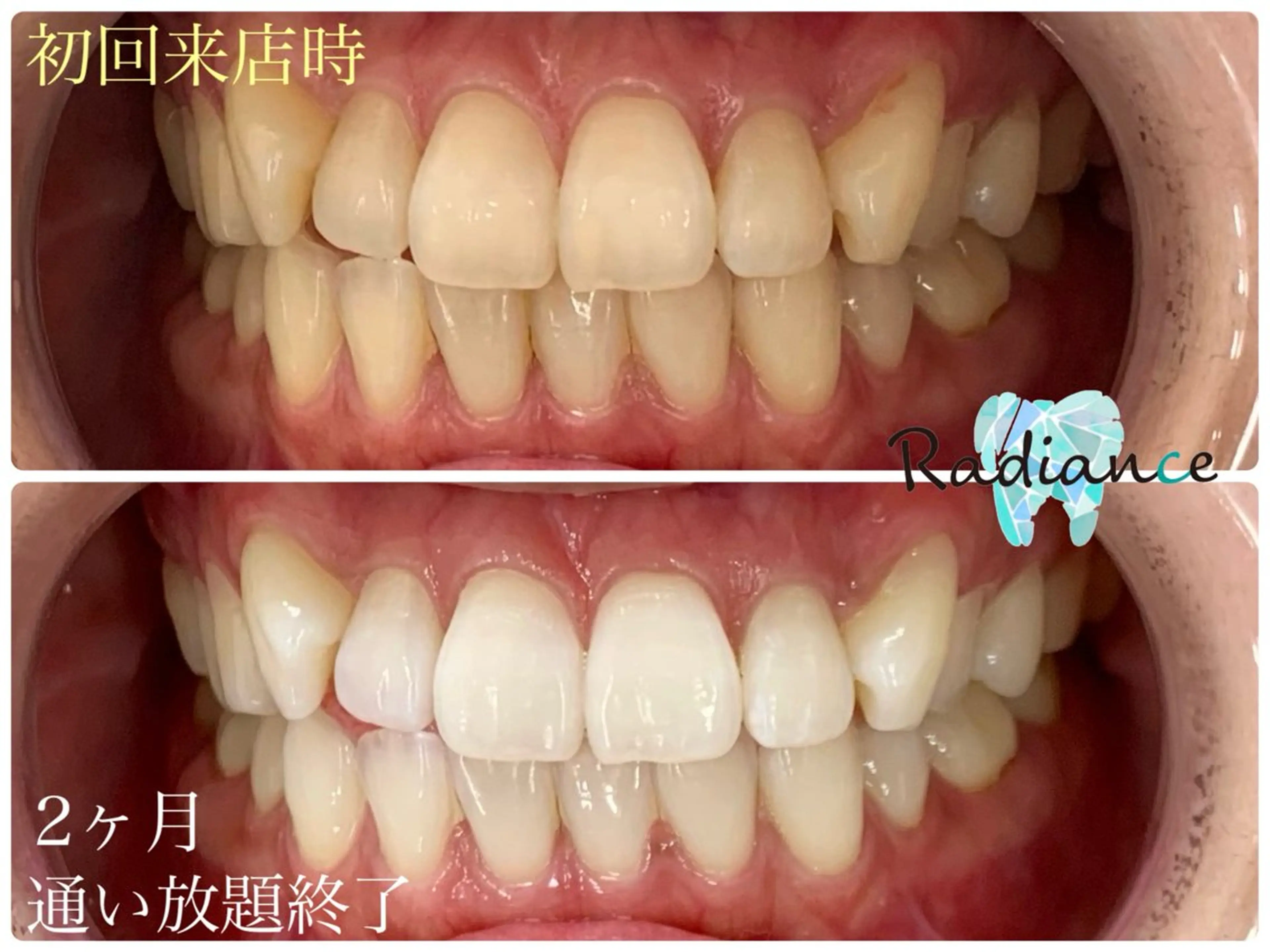 札幌ホワイトニング ラディアンス札幌駅店のその他イメージ