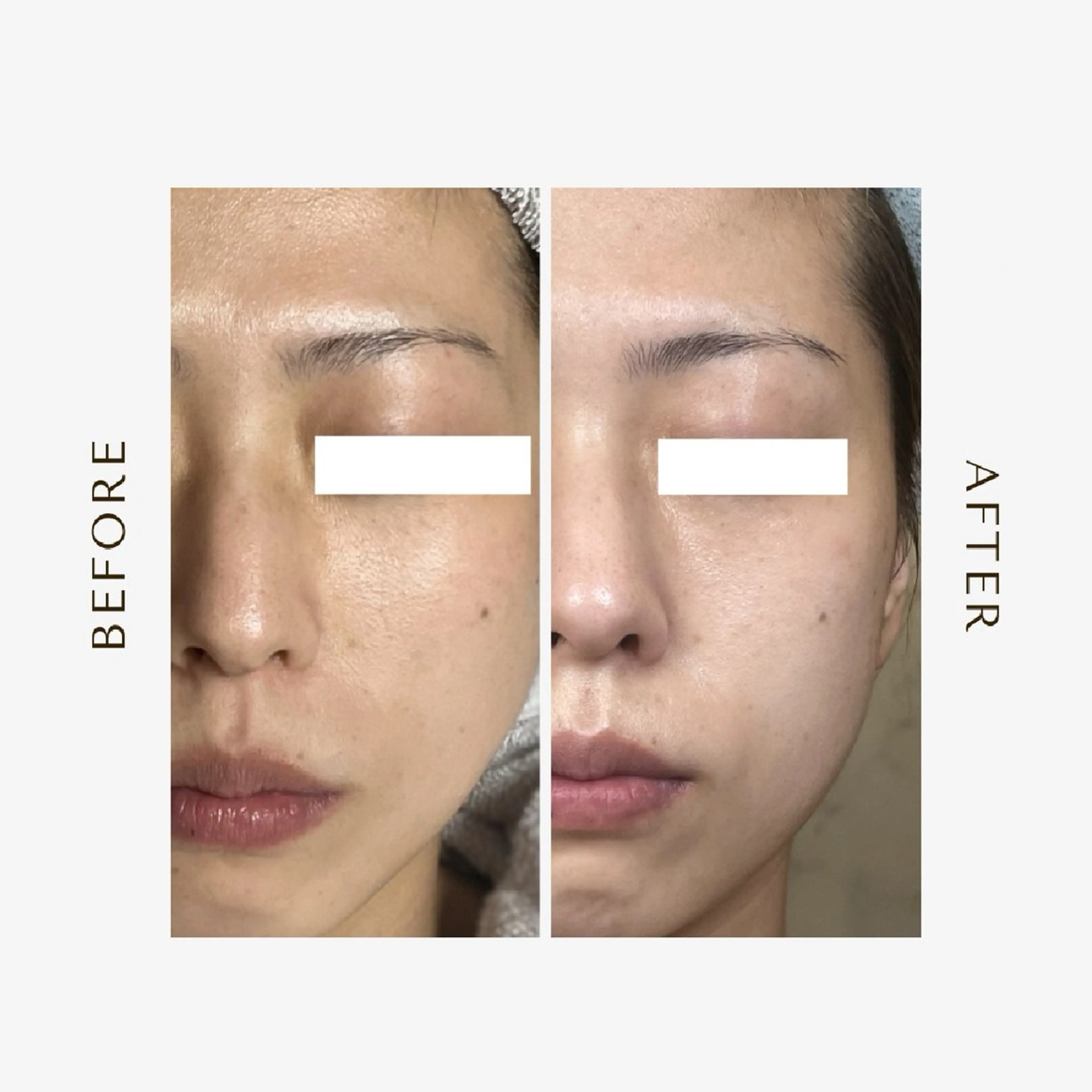 エステ ROR Akariのエステ・リラクイメージ