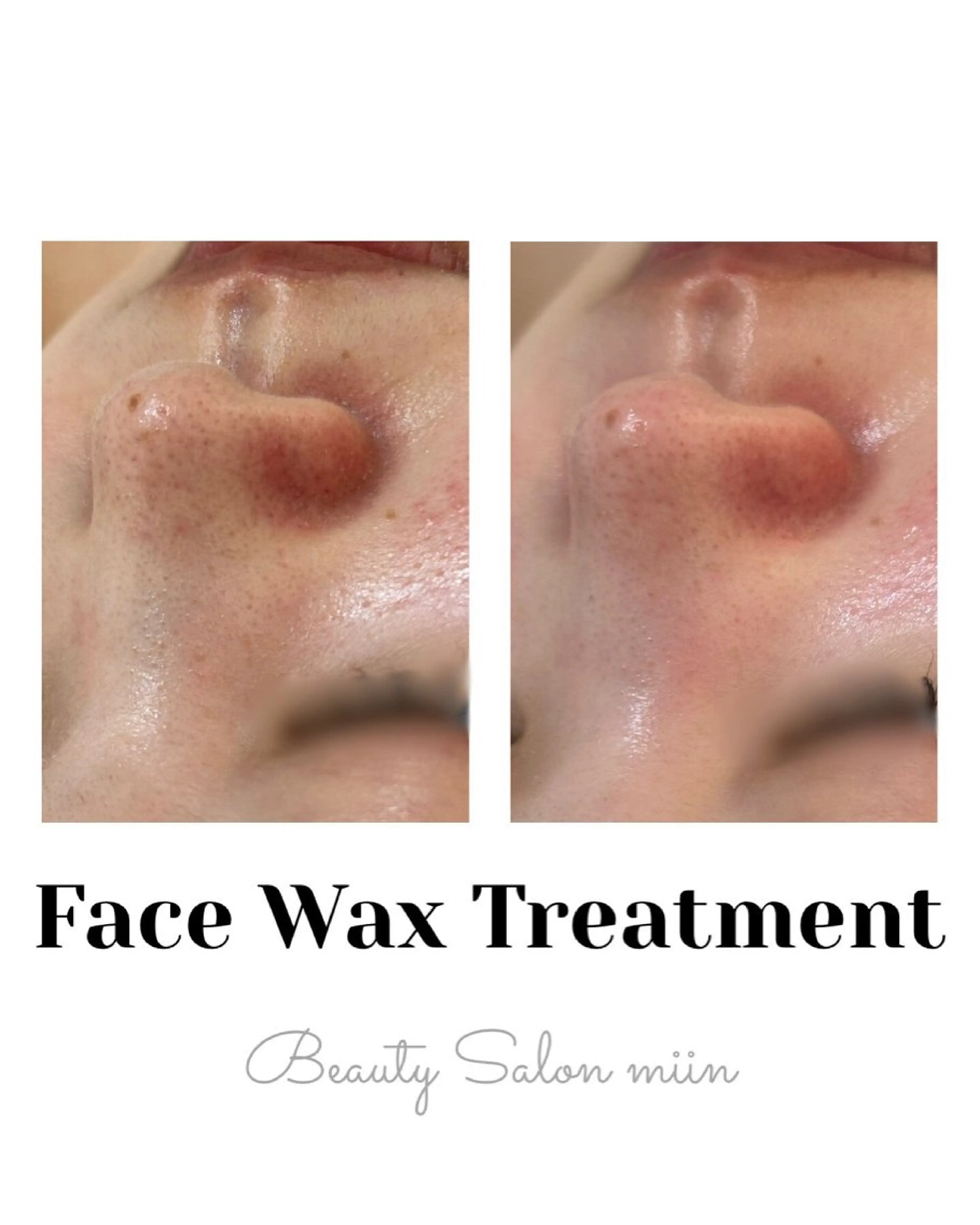 リラク 韓国肌管理 白玉肌管理®︎のエステ・リラクイメージ