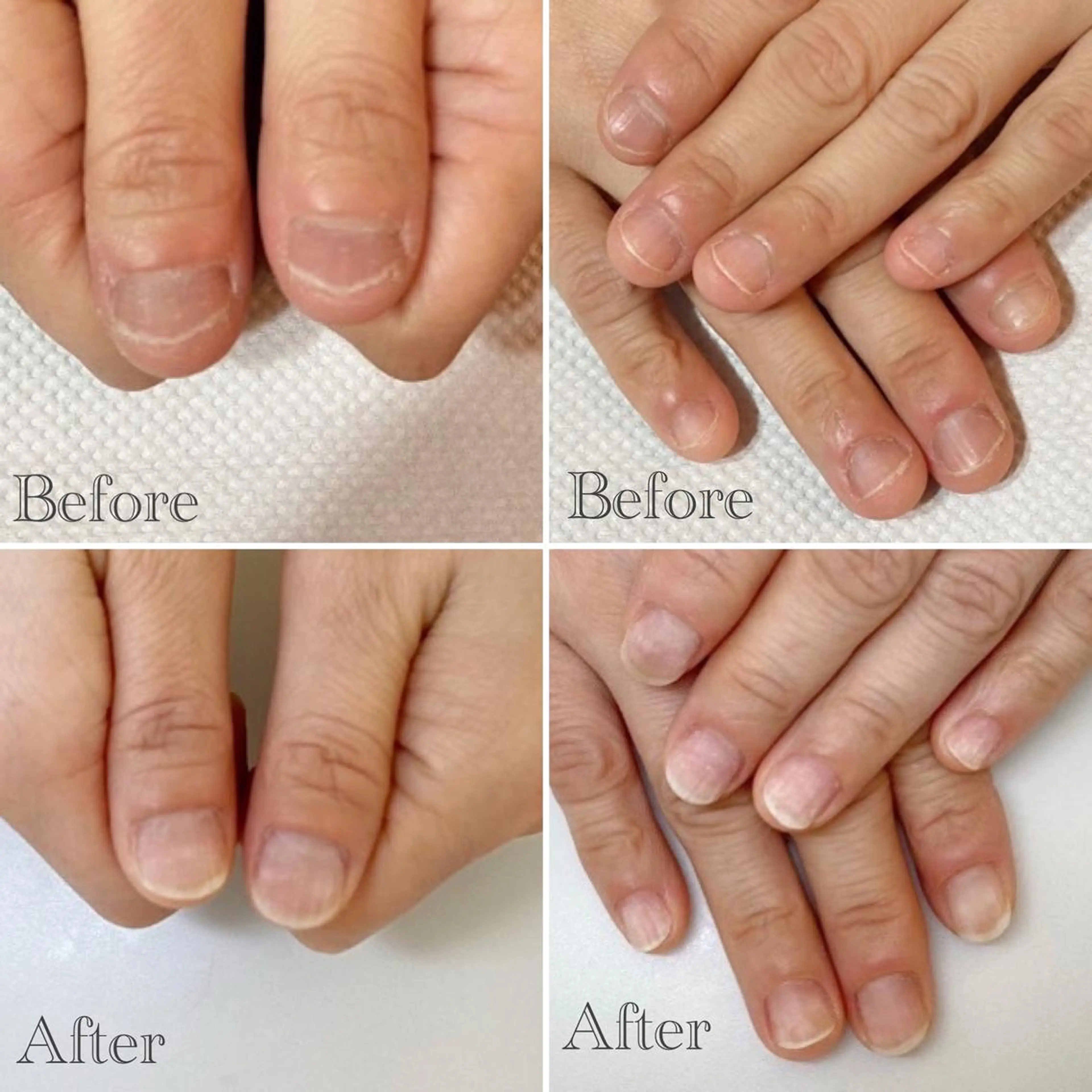 ネイル ネイルサロン アリュームのネイルデザイン