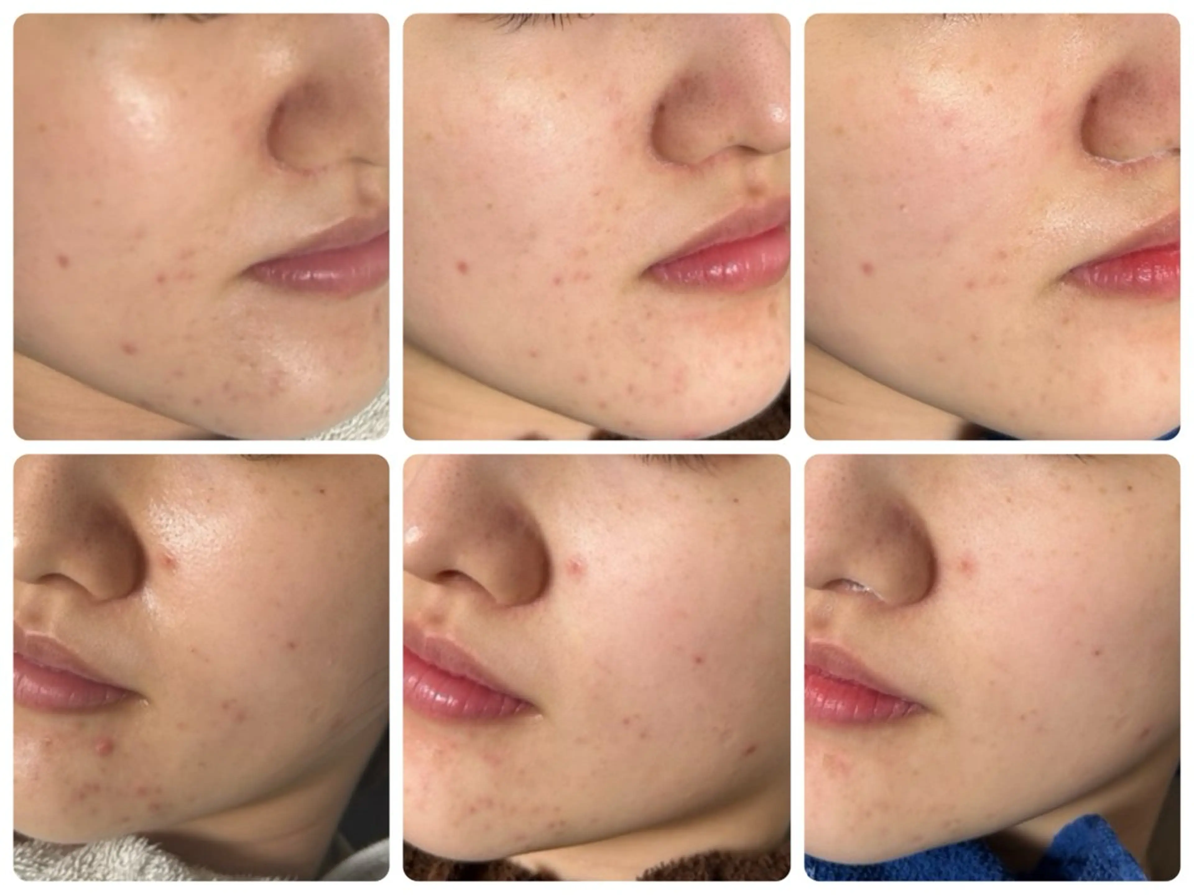 エステ 毛穴・肌質改善サロン ✨Tomaのその他イメージ