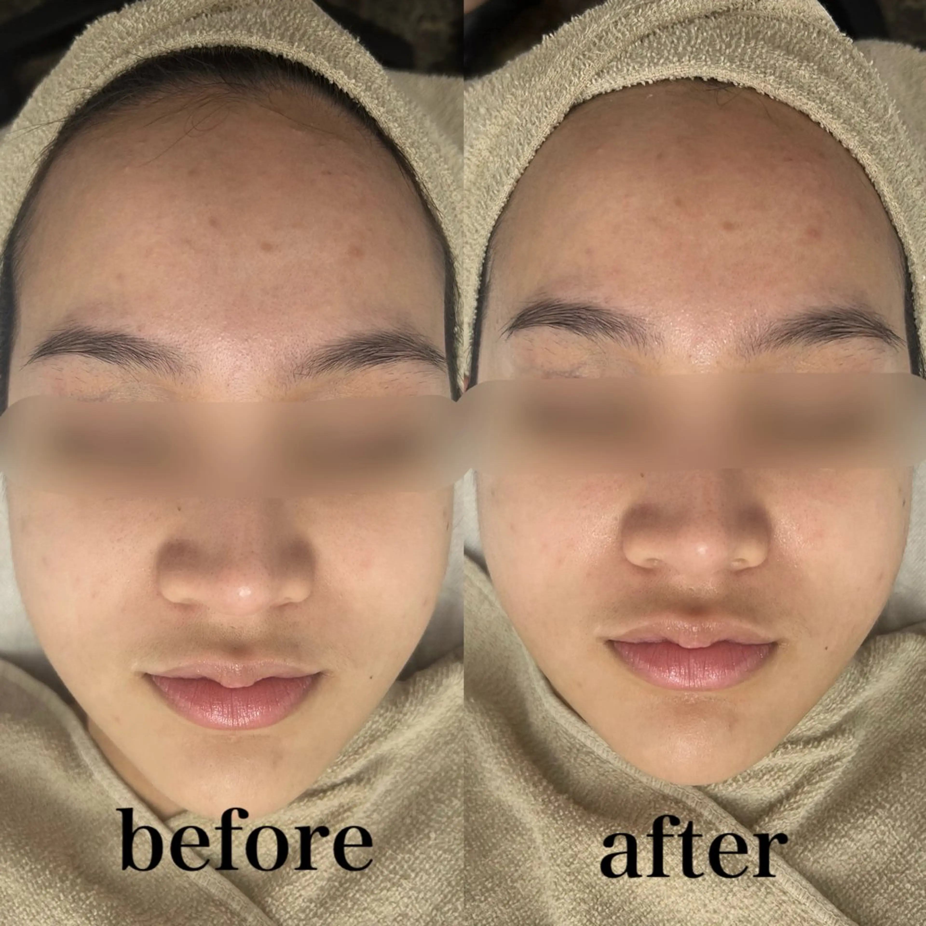 エステ フェイシャルサロン CHIARA 荒田のエステ・リラクイメージ