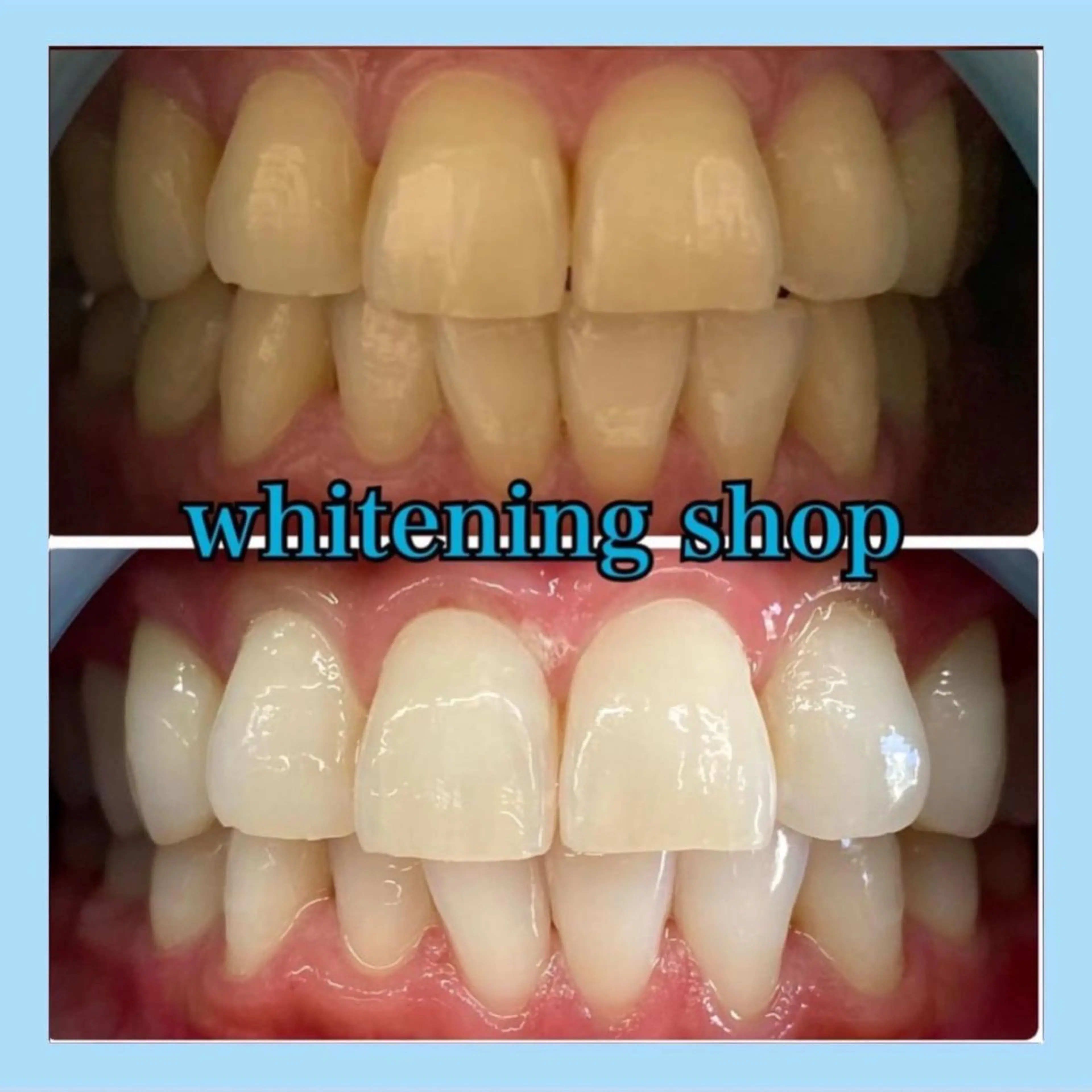 ホワイトニング ショップ千葉店のその他イメージ