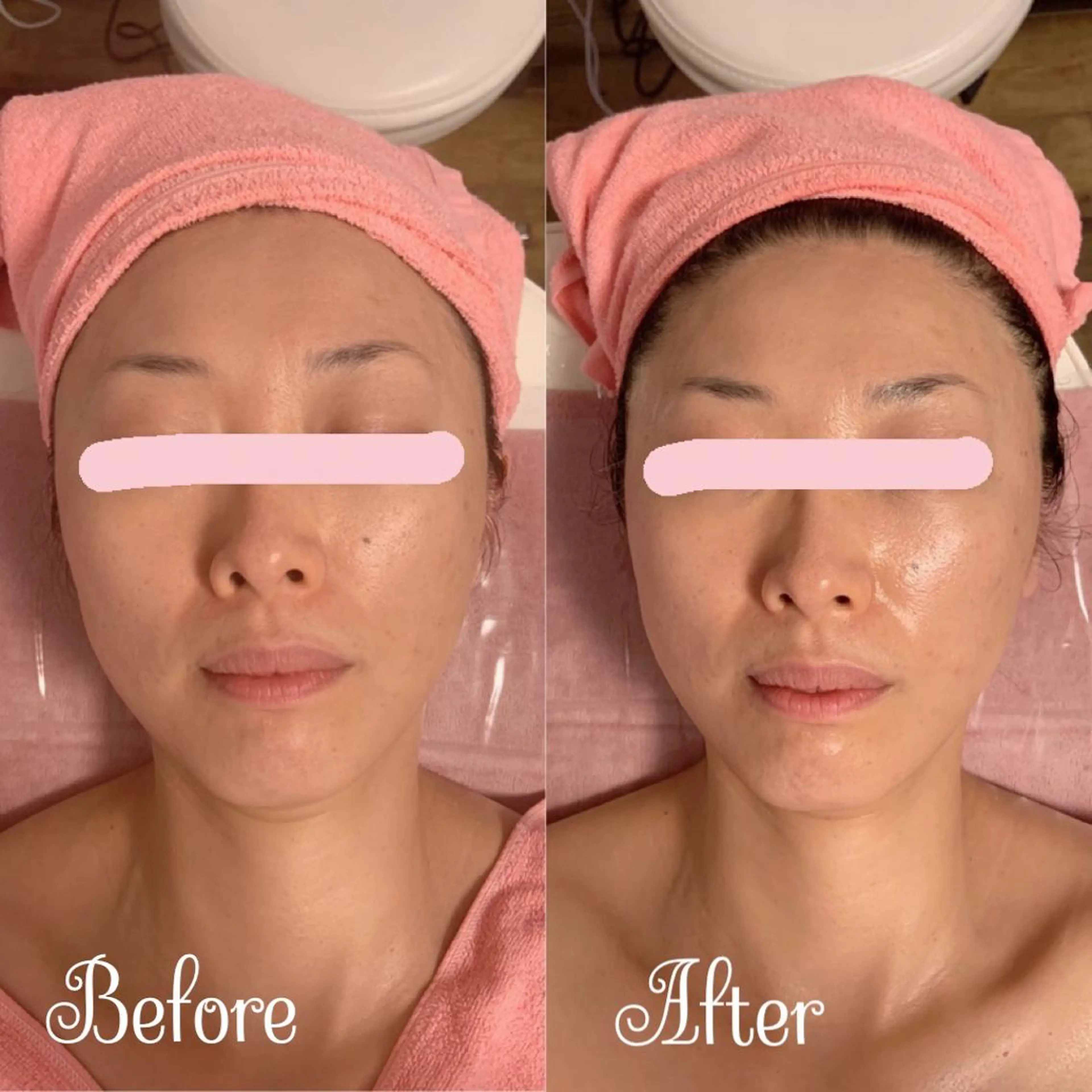 Linomalie エステ/たるみ/脱毛のエステ・リラクイメージ