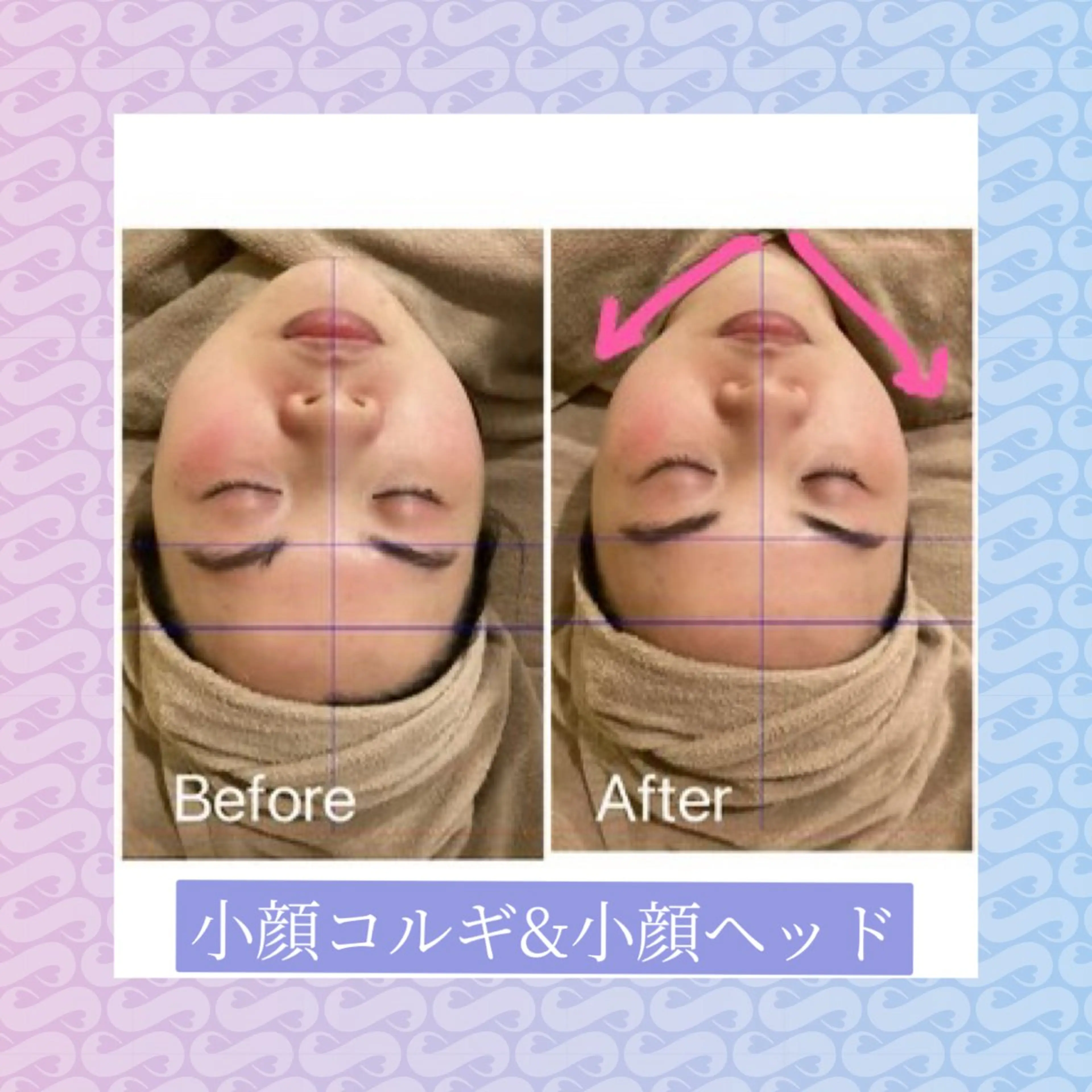 小顔フェイシャル(毛穴洗浄&美白ケア)の写真