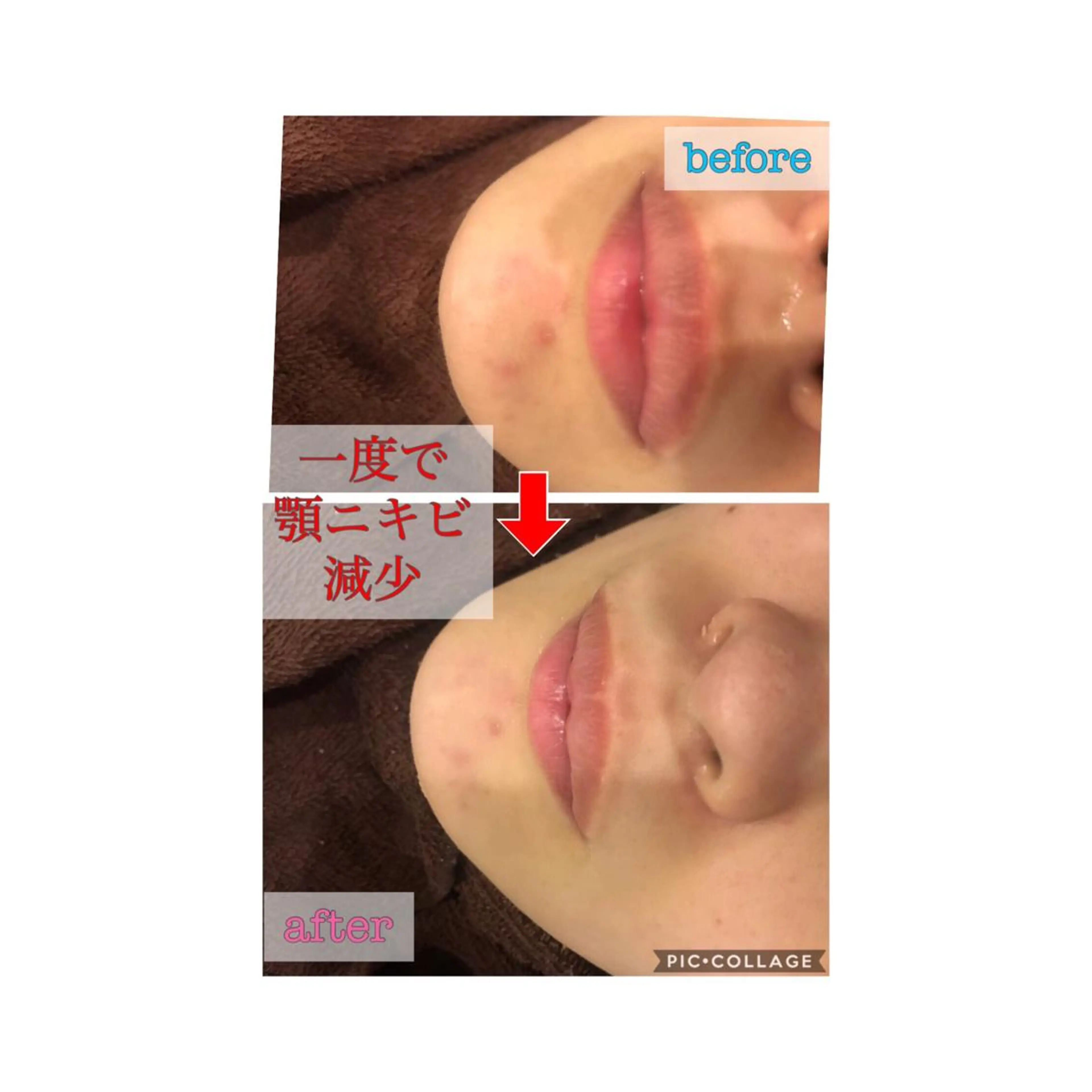 セミロング カラー パーマ ヘアアレンジ メンズ キッズ ネイル マツエク・マツパ 金の糸脱毛 産毛ケア専門のエステ・リラクイメージ