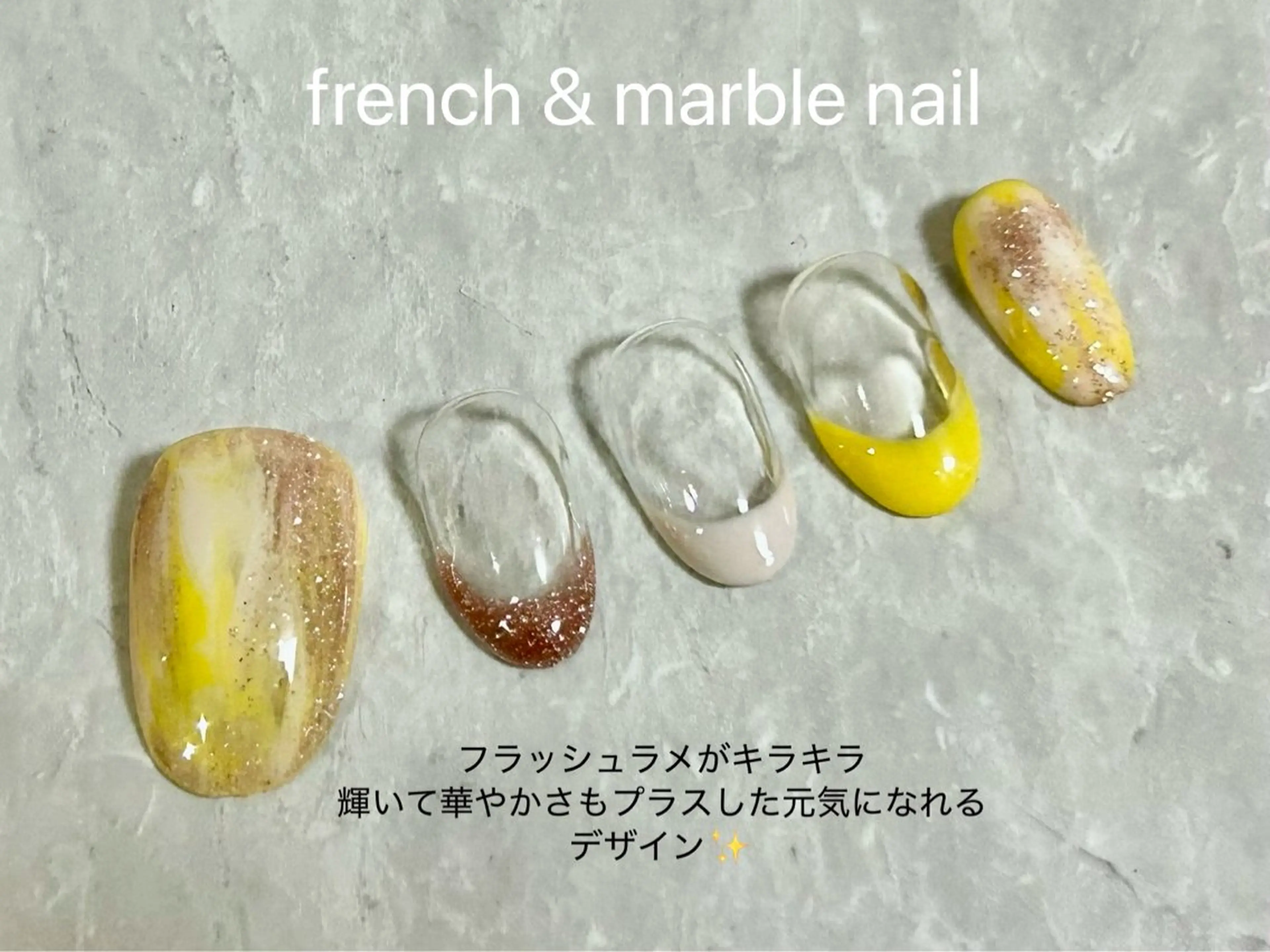 定額ネイルの写真