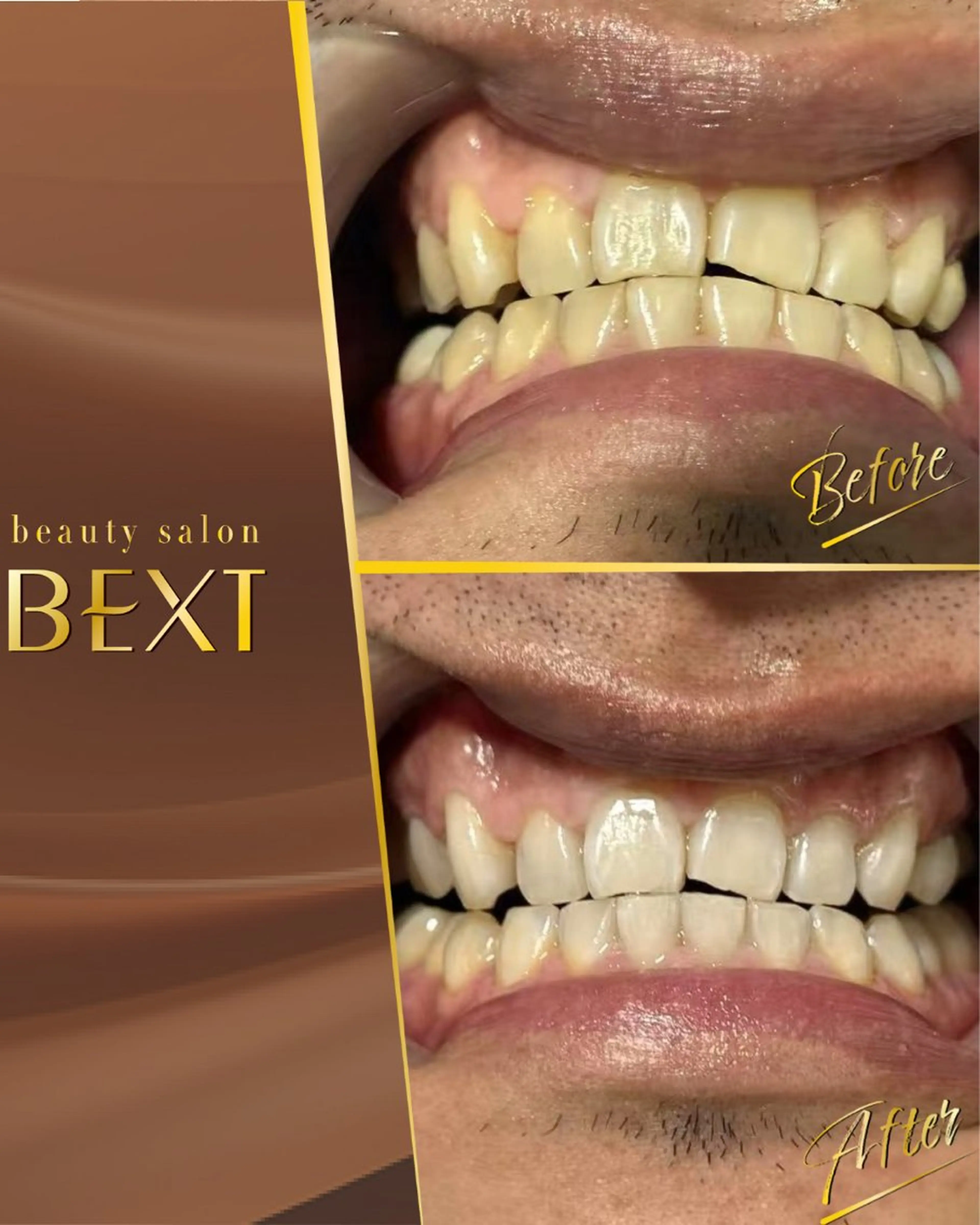 【結果重視】セルフホワイトニング(10分×2回照射)たった20分で明るい印象に♪名古屋駅・ささしま近くの写真