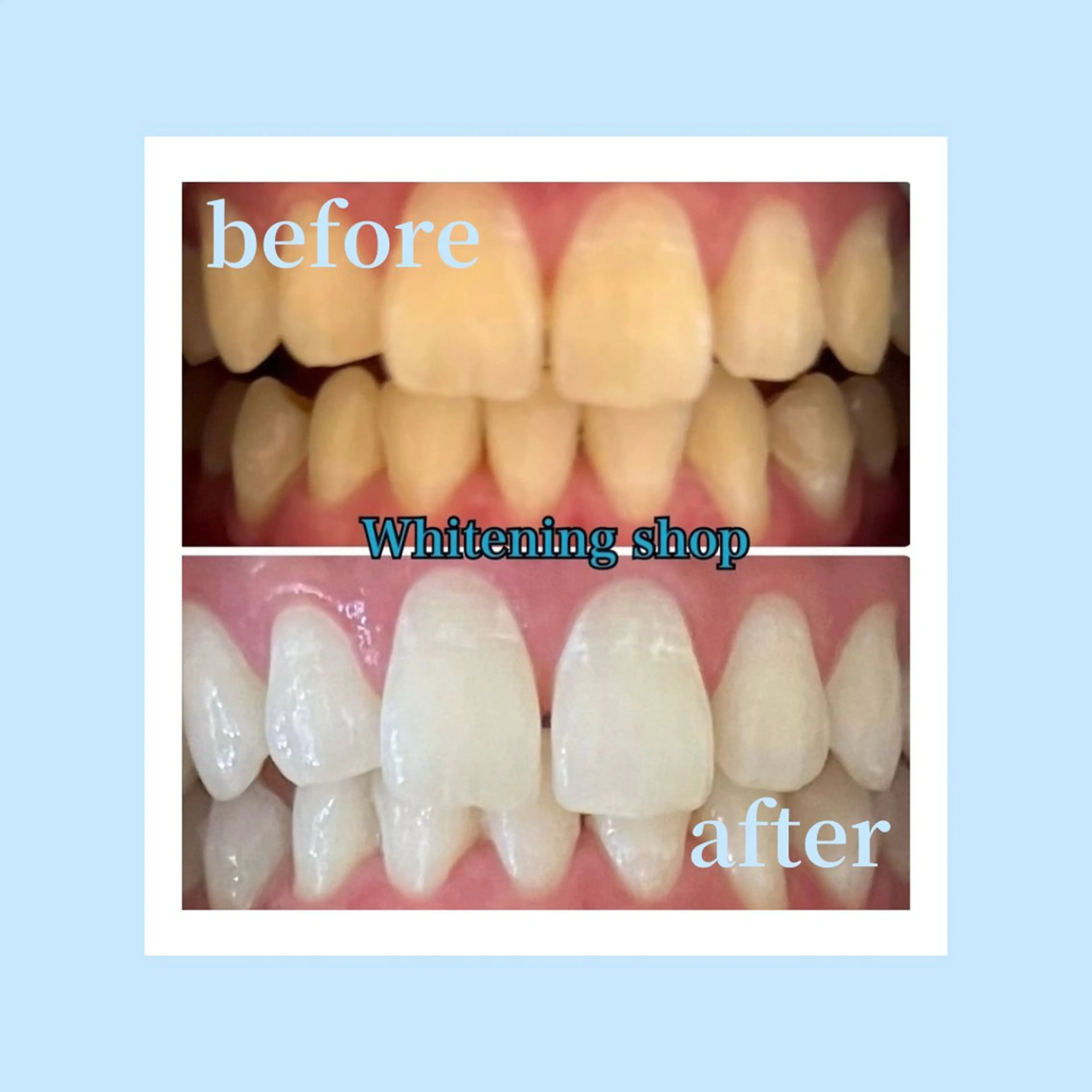 ホワイトニング ショップ光明池店のエステ・リラクイメージ