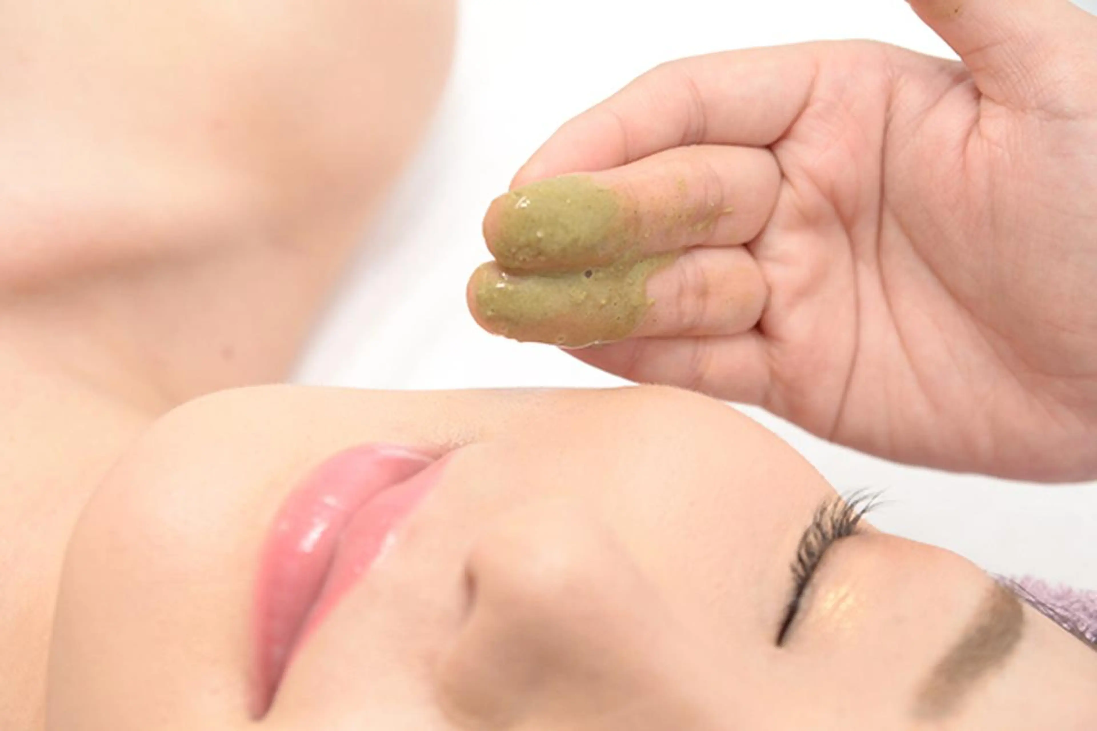 🌿ハーブピーリング🌿【剥離なし】ニキビ、ニキビ跡、黒ずみザラつきアトピーが気になる方にオススメ◎艶肌白玉肌の写真