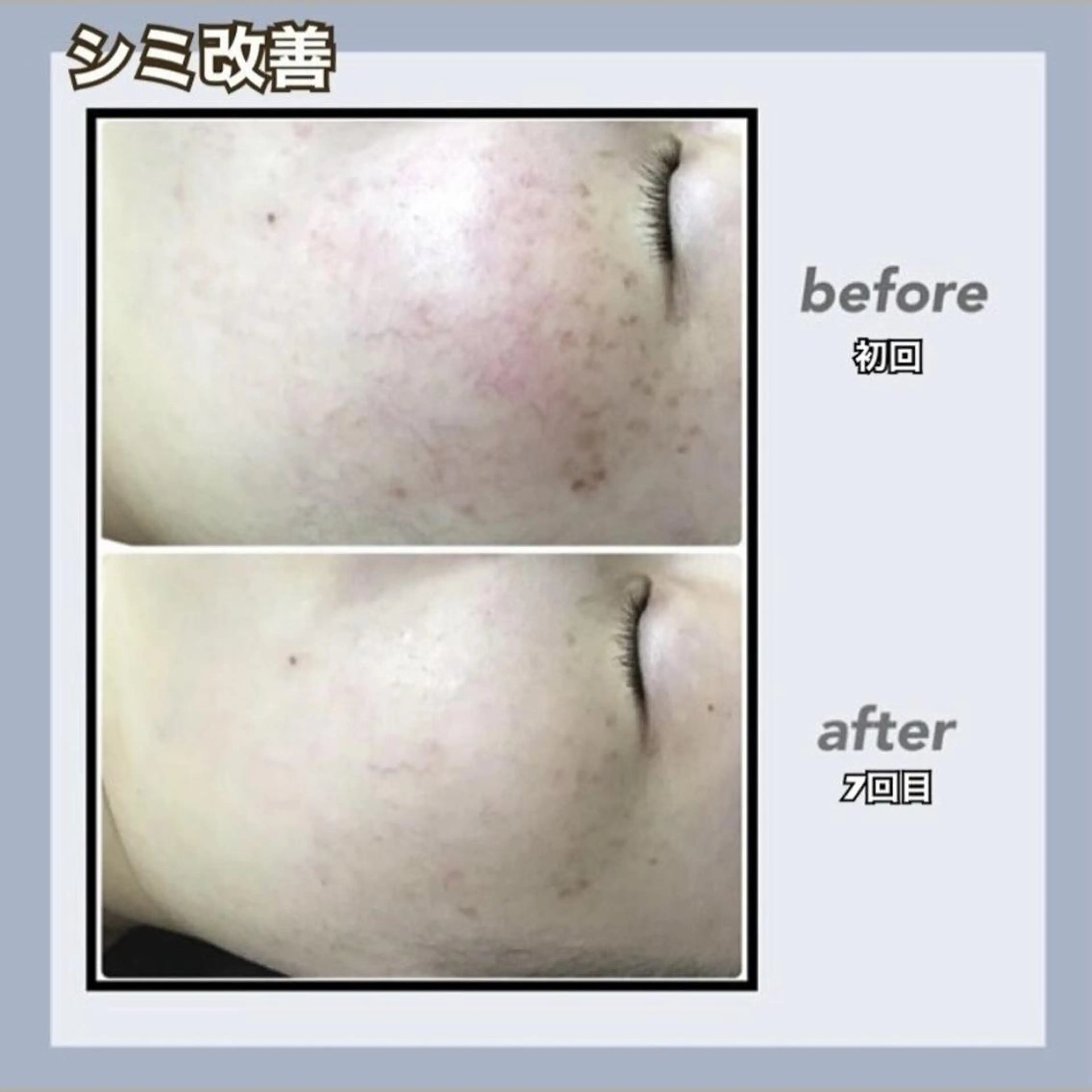 🌿小顔・痩身・脱毛 レイビス川崎店🌿のエステ・リラクイメージ