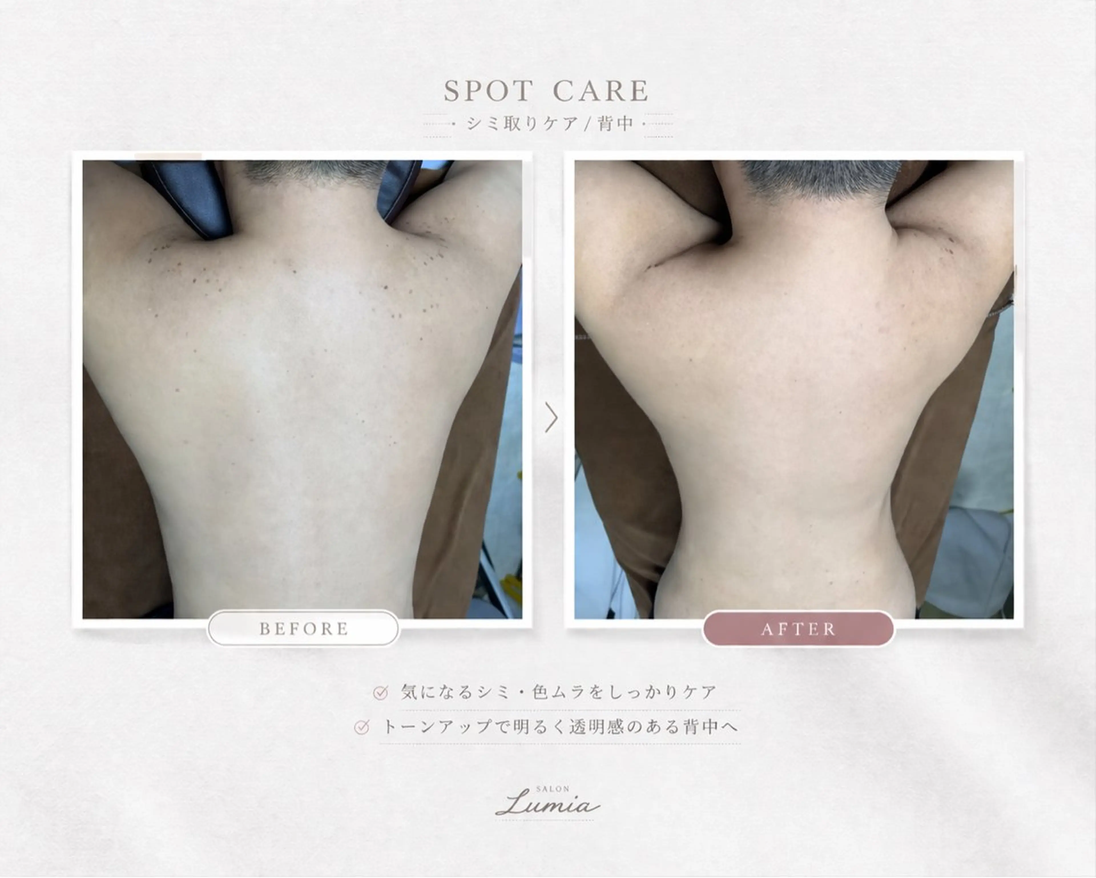 その他 脱毛 サロン🤎のエステ・リラクイメージ