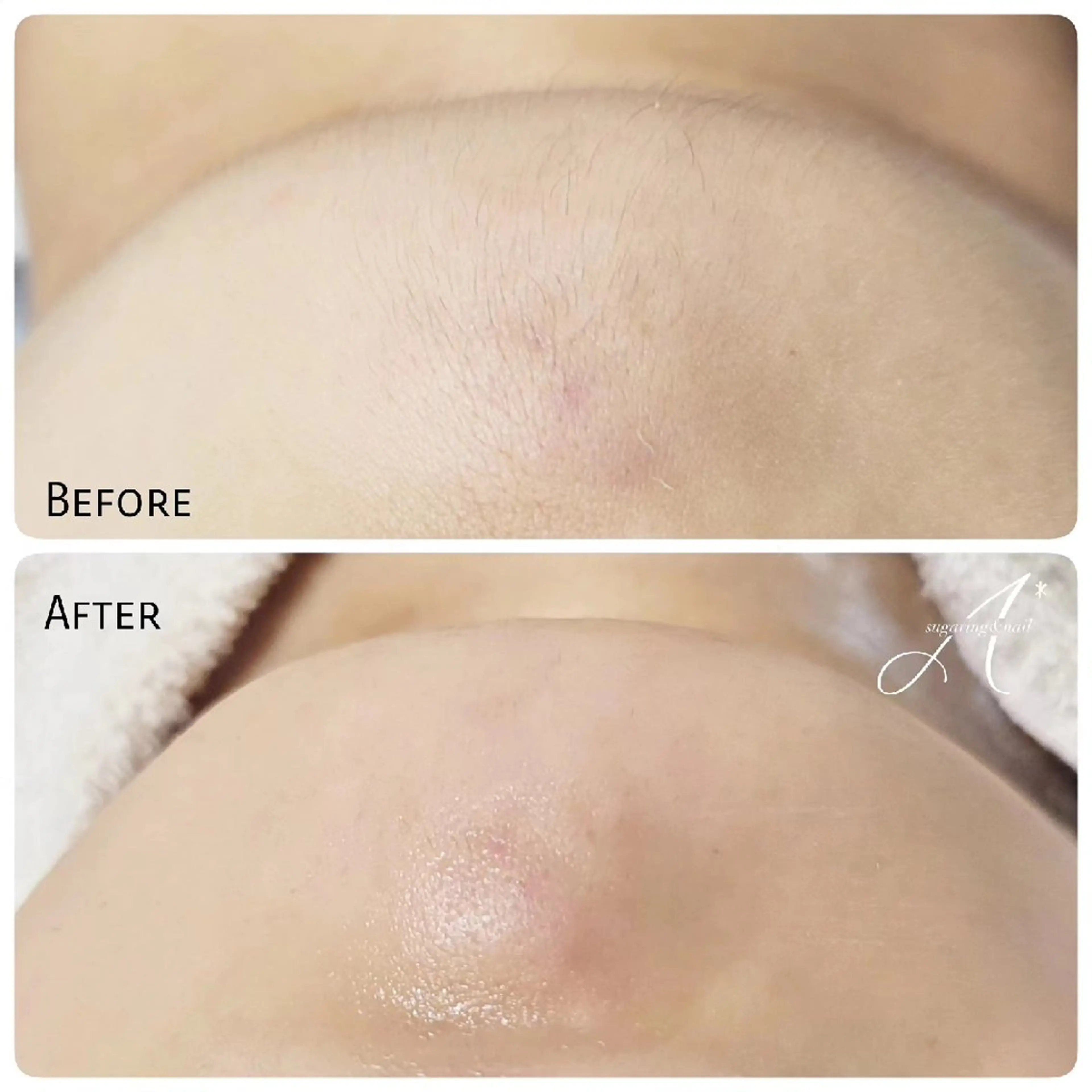 その他 A*《エースター》 シュガーリング🍋のエステ・リラクイメージ