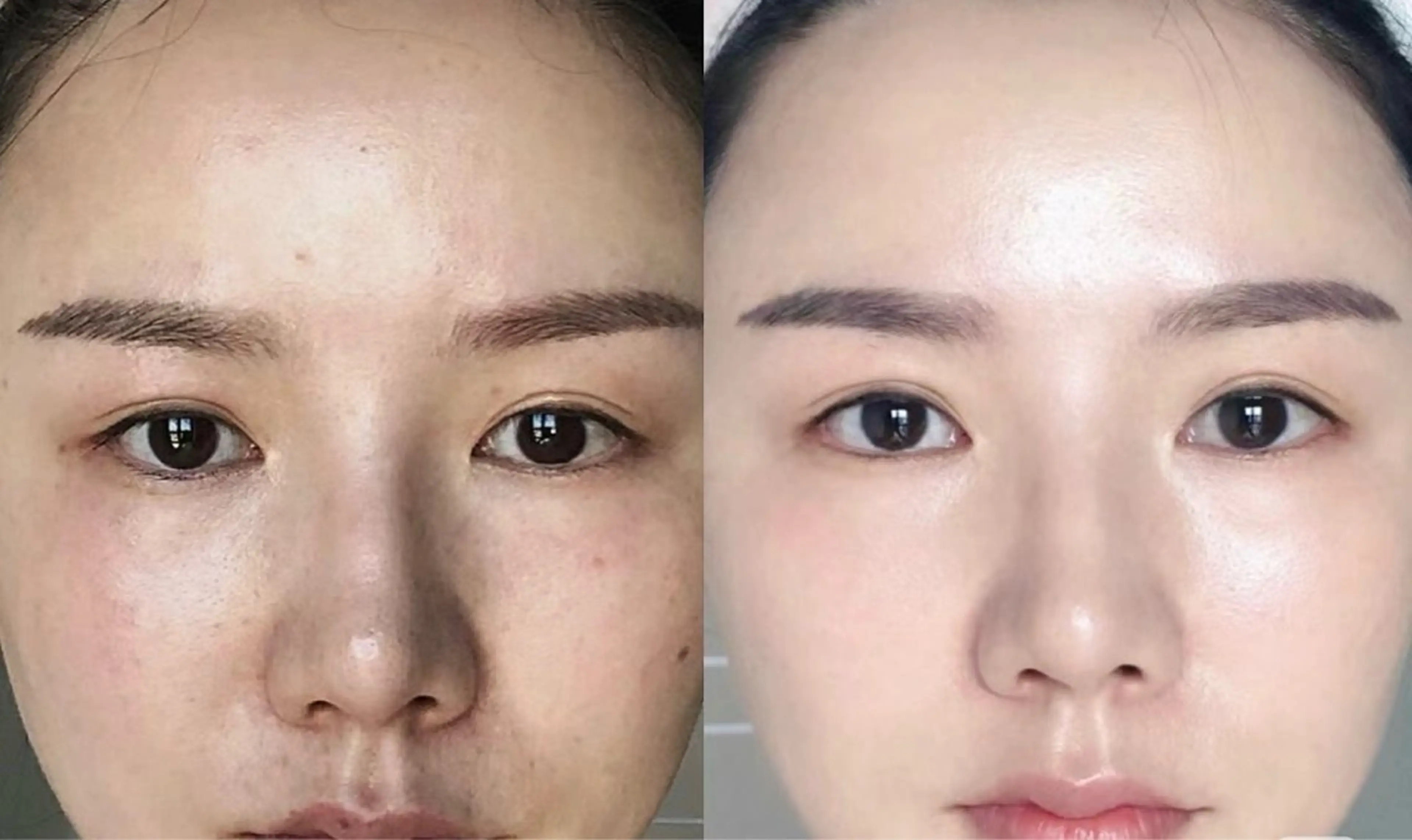 ネイル エステ aliaハーブ水光店 エステティシャン募集のエステ・リラクイメージ