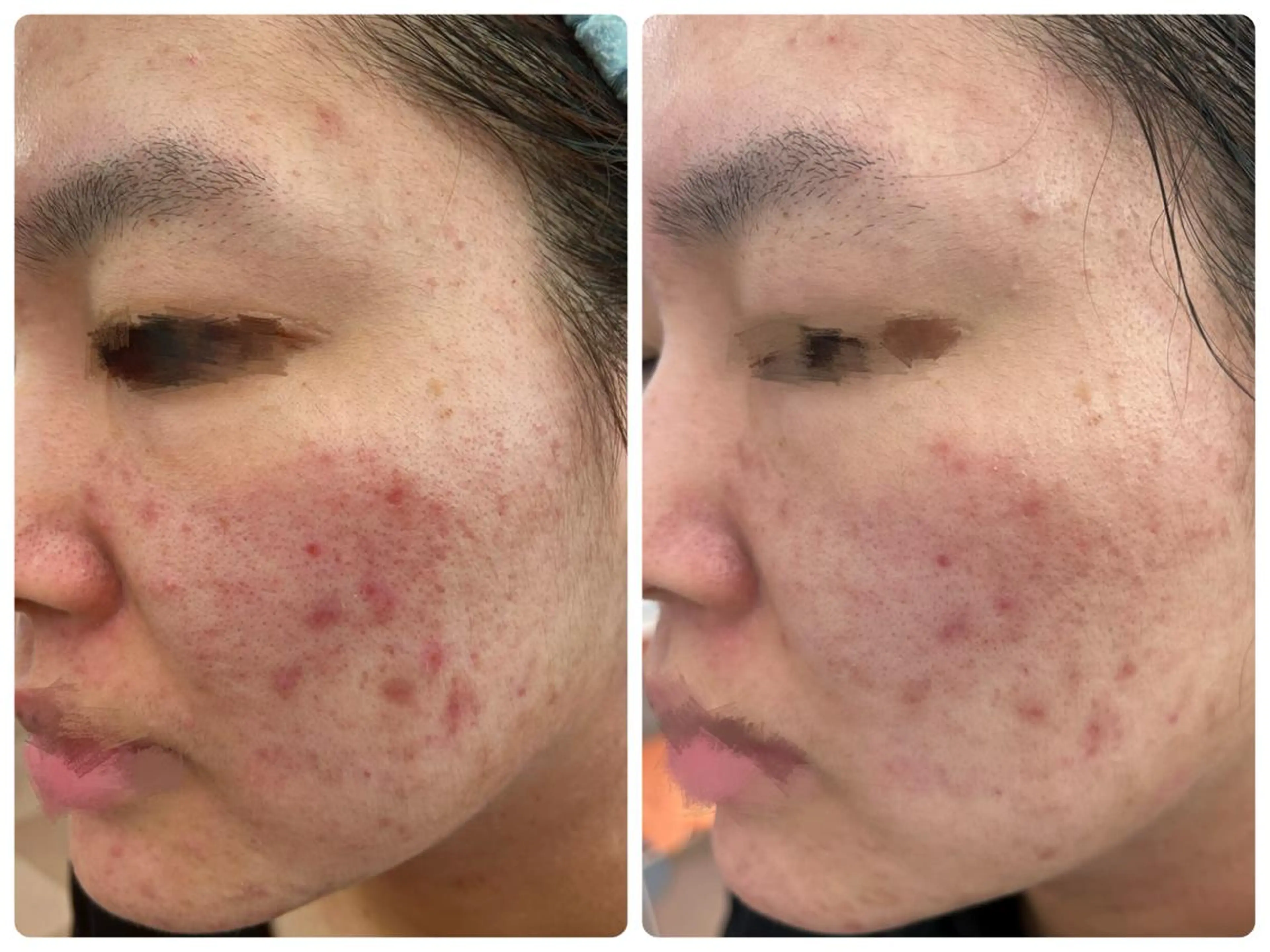 DeI'm 丸亀店所属・いおもり あやかのエステ・リラクイメージ