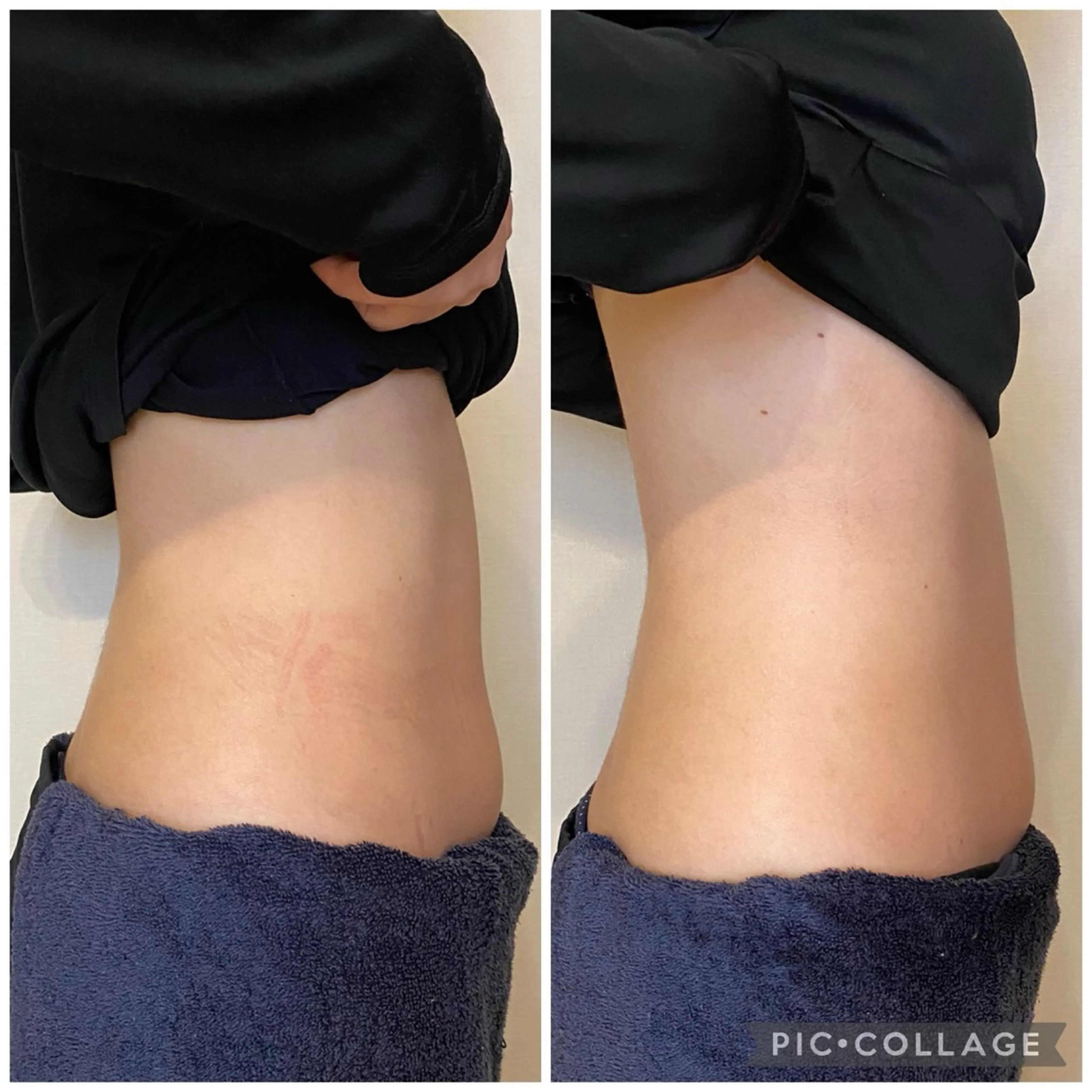 腸セラピーサロン ナチュモアのエステ・リラクイメージ