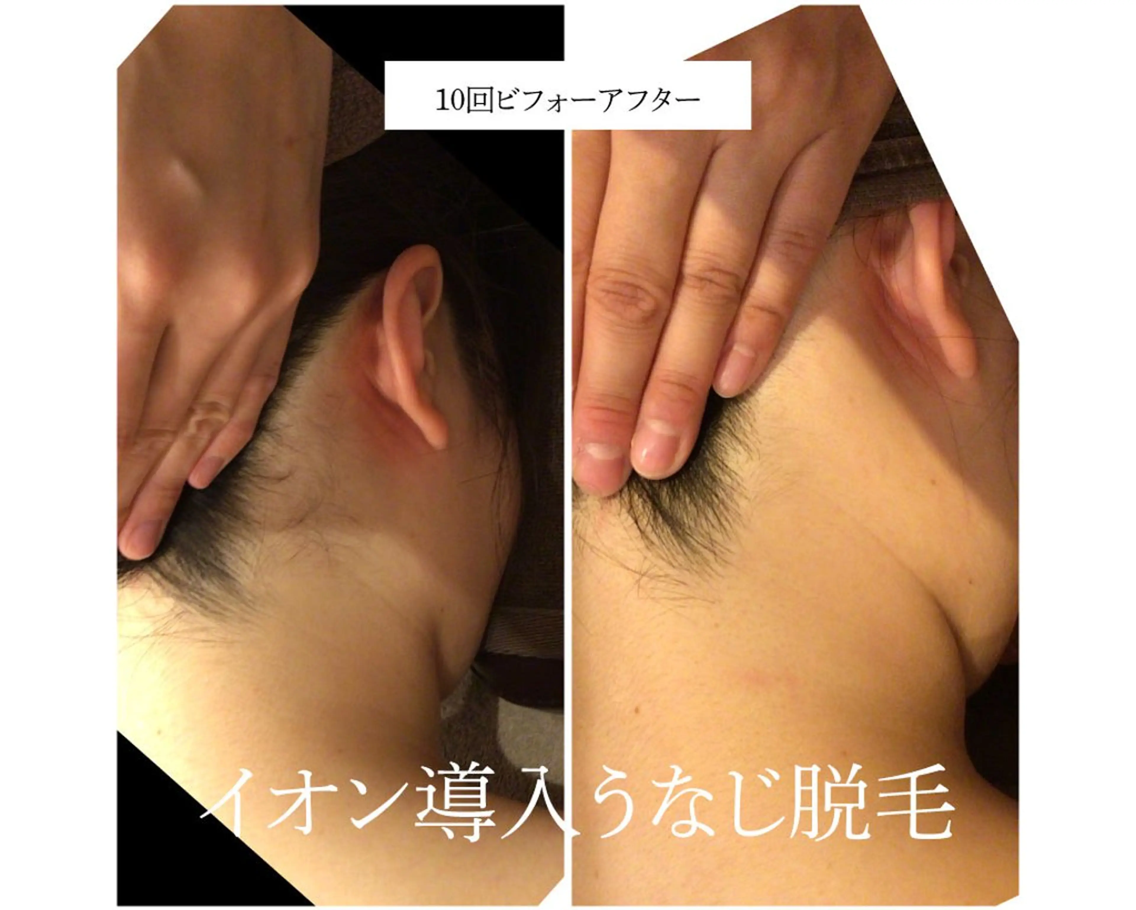 脱毛 🎀うなじ脱毛🎀 ㅣLino堀江のエステ・リラクイメージ