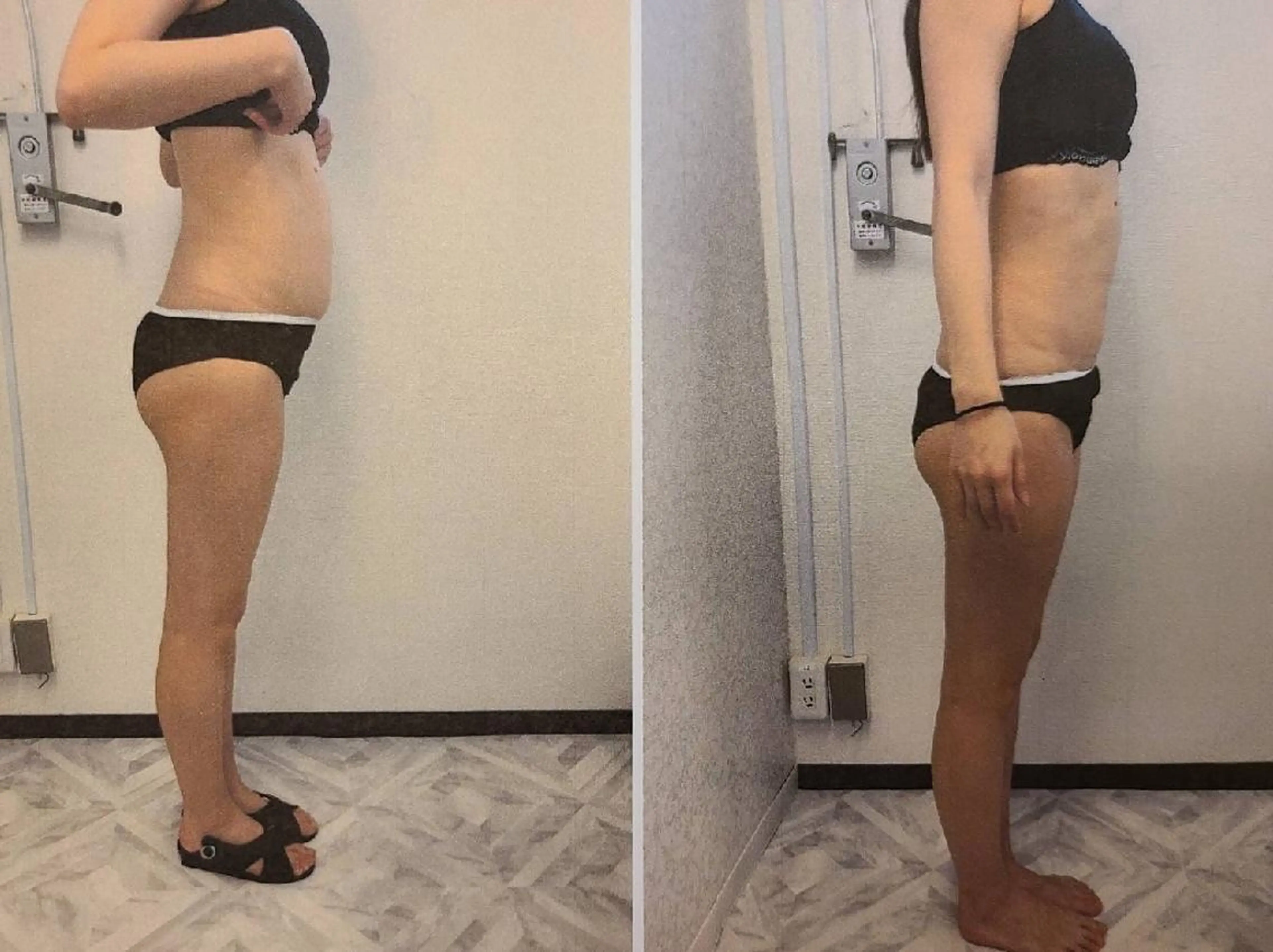 お試しキャビテーション&ラジオ波(18歳以上⚠️高校生不可)の写真