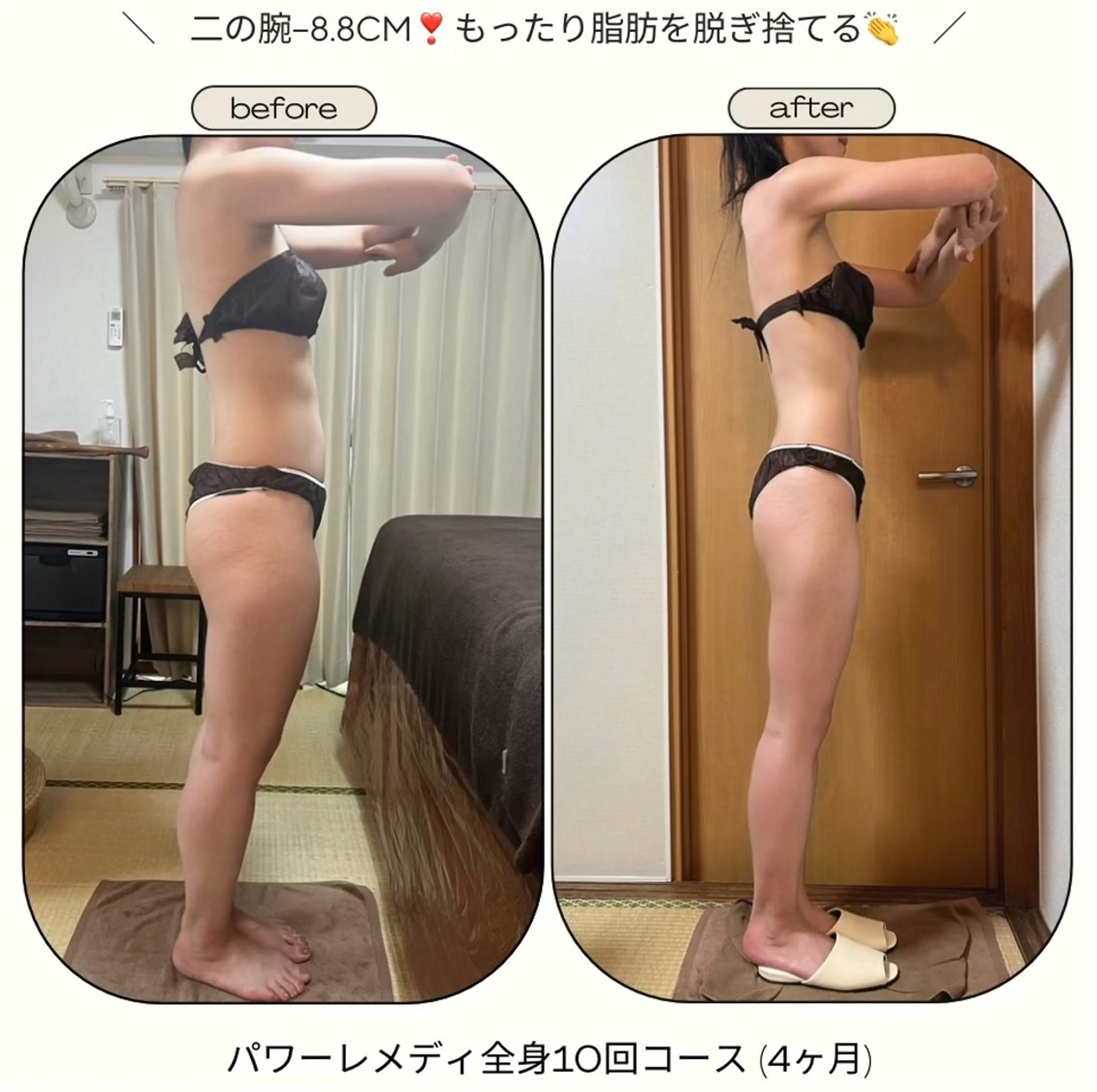 《本気痩せ×疲労改善 》  BILOOPのエステ・リラクイメージ
