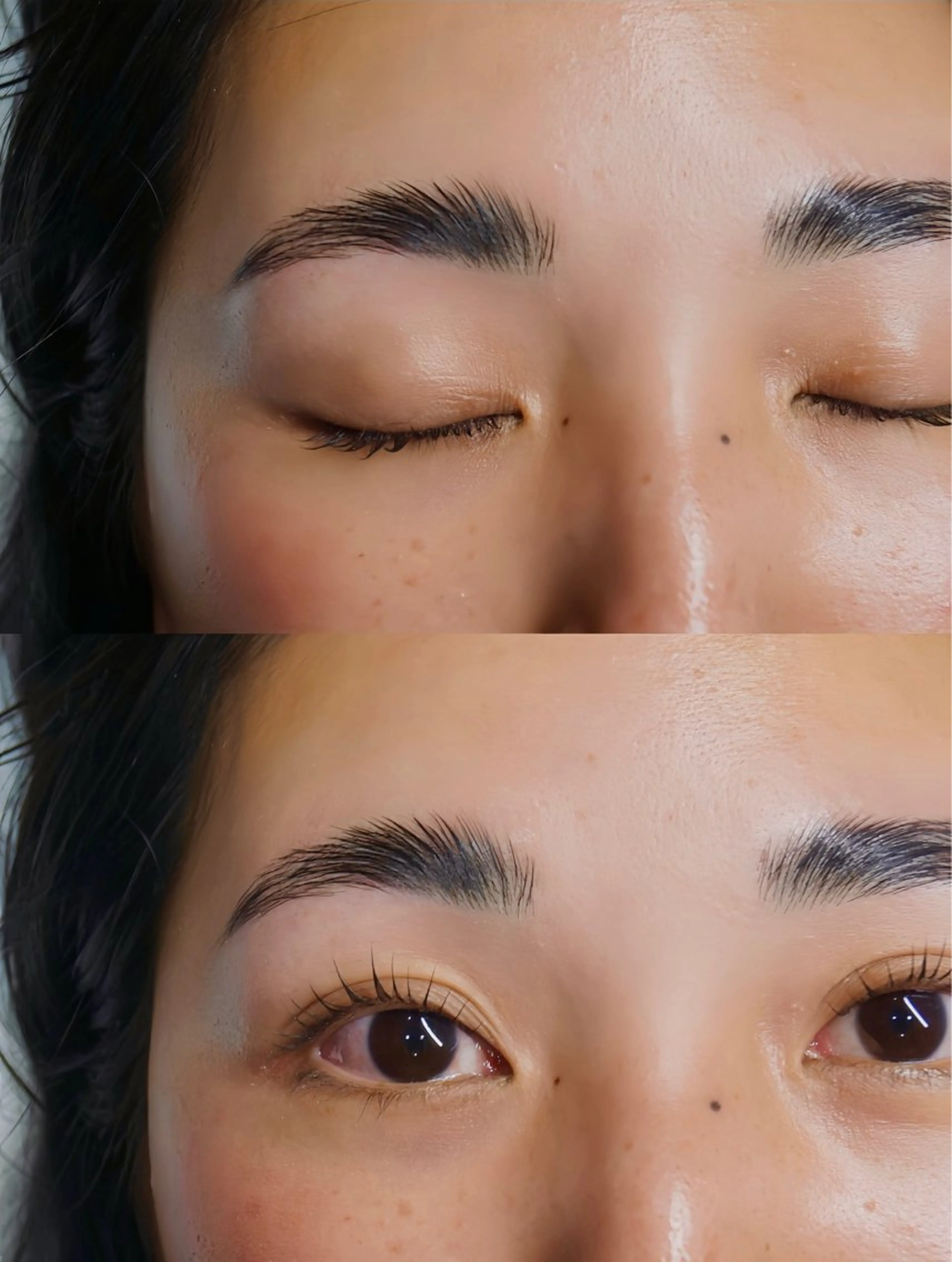 ブロウリフトの写真