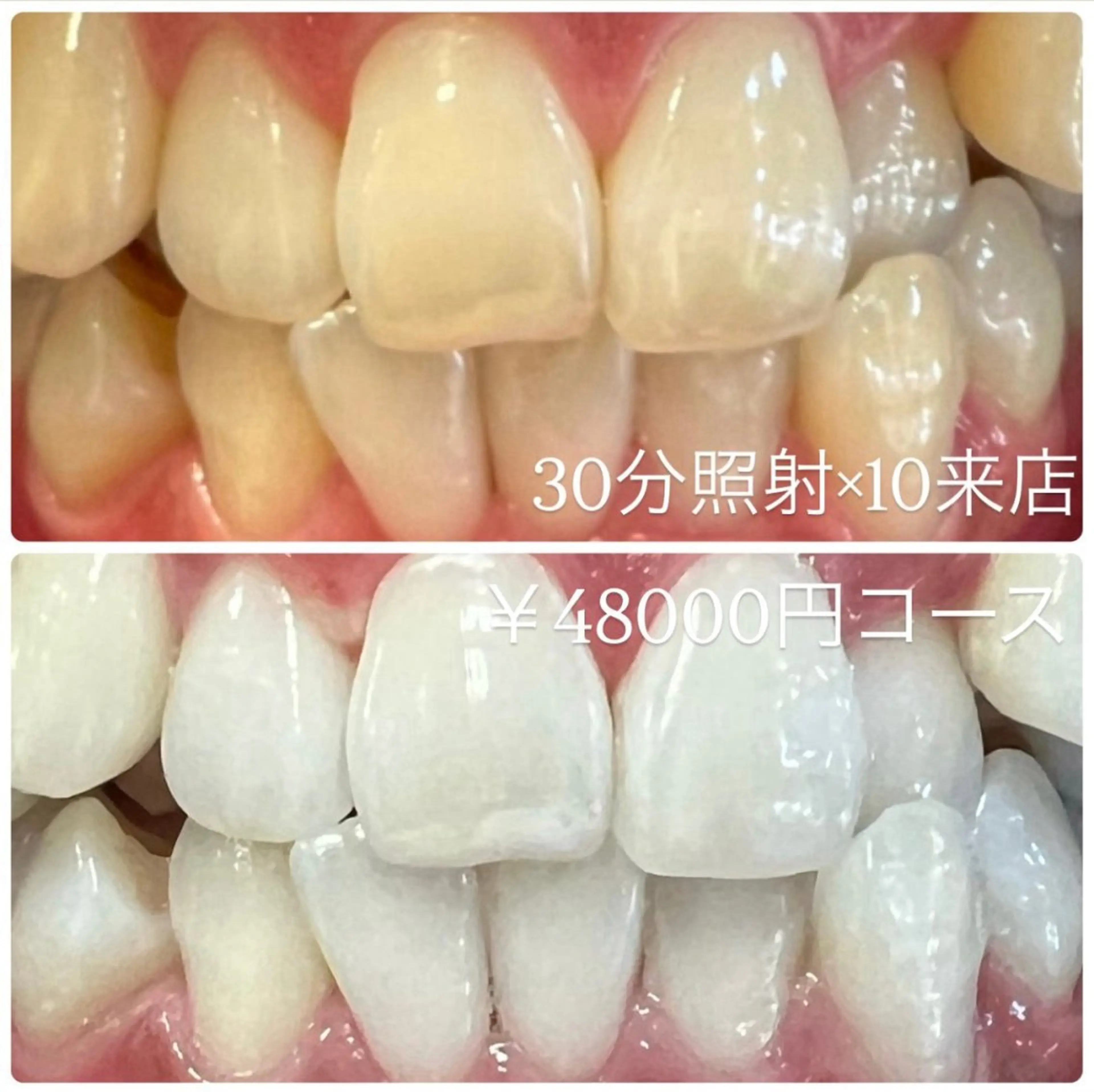 その他 PLATINUM Beauty 横浜店所属・ホワイトニングルーム 横浜店のその他イメージ