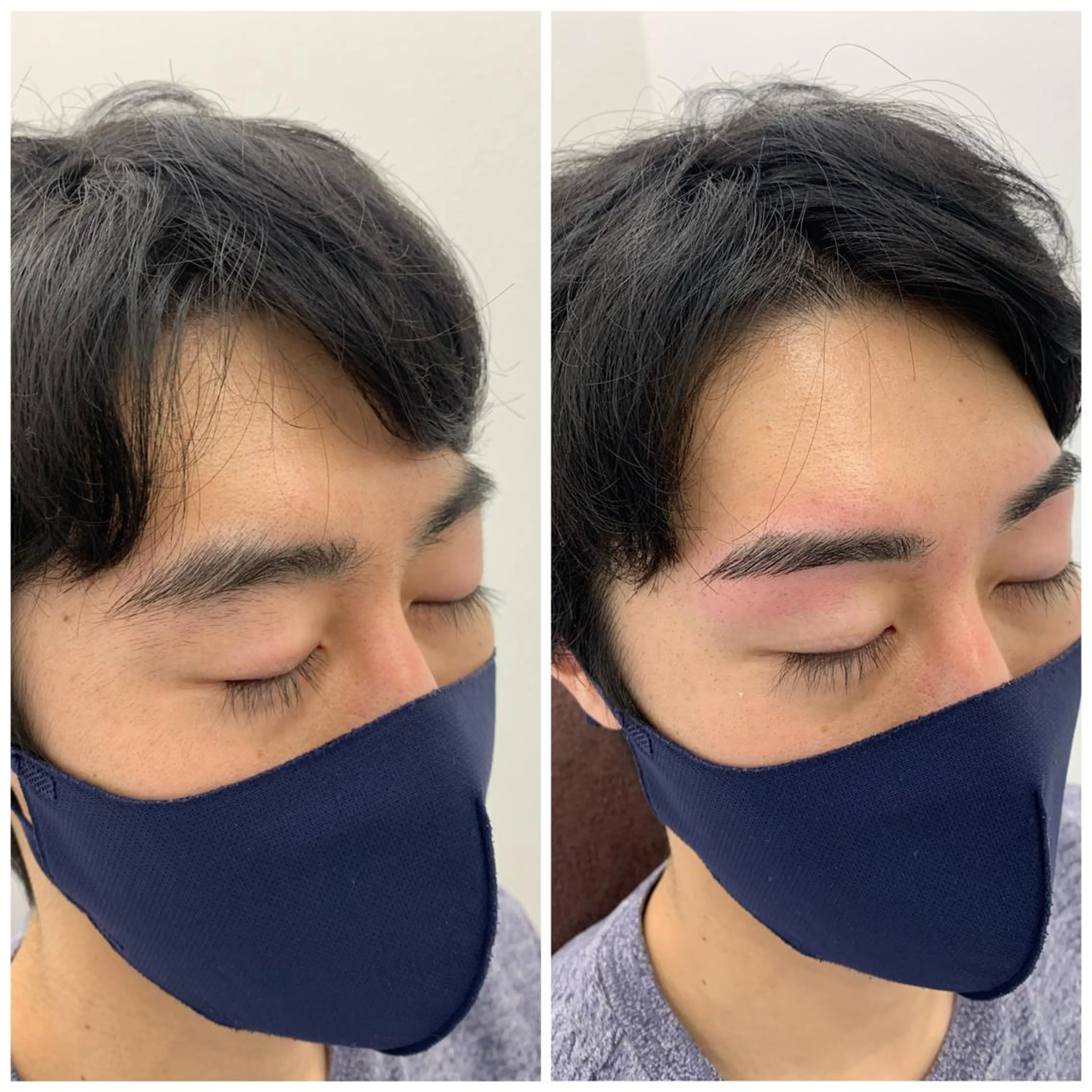 メンズアイブロウスタイリング(WAX脱毛)の写真