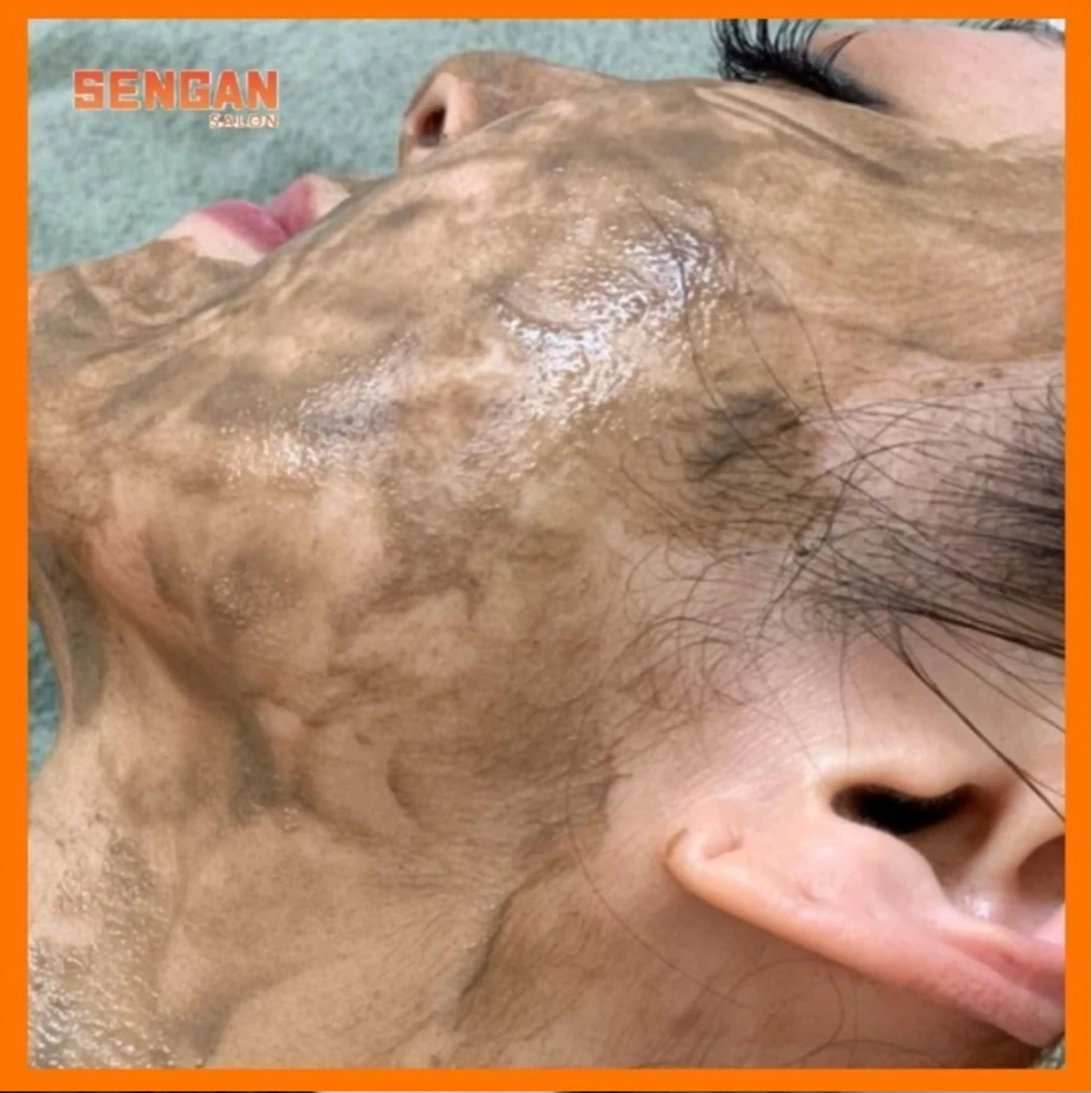 エステ 洗顔サロン池袋 毛穴洗浄のその他イメージ