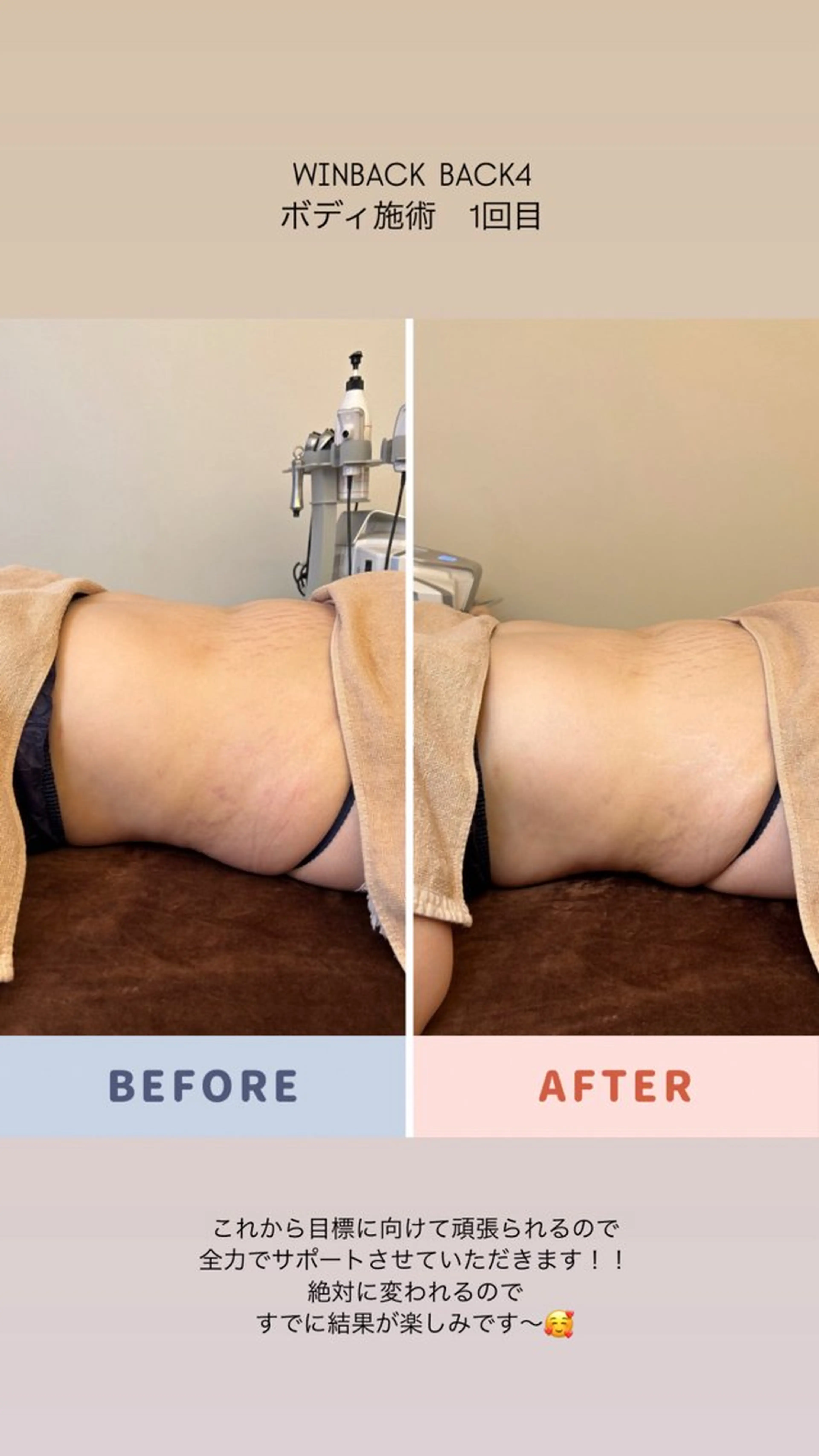 エステ les SALON所属・美肌脱毛／慢性疲労 ／肩こり／むくみのエステ・リラクイメージ