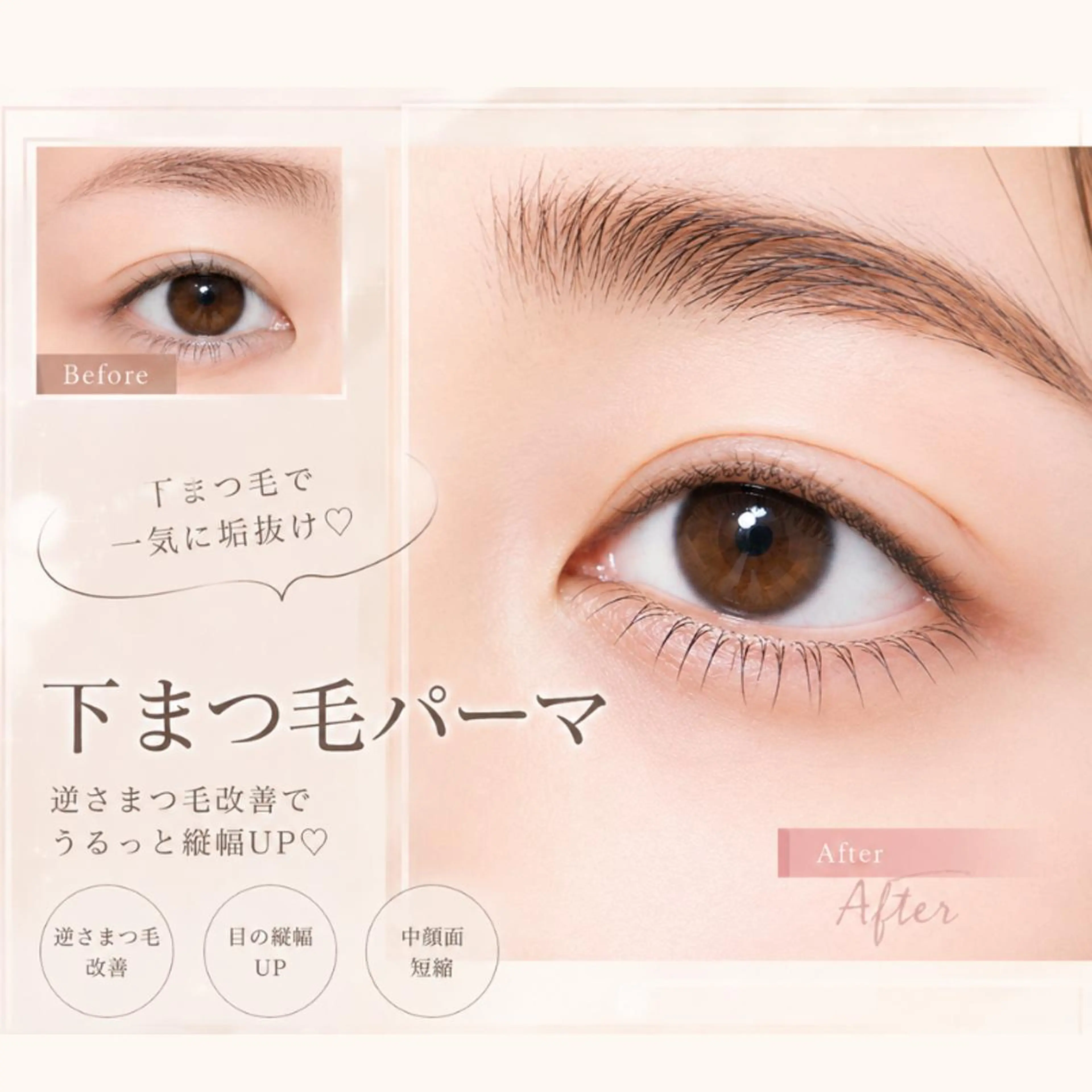 下まつげパーマ*.+゚の写真