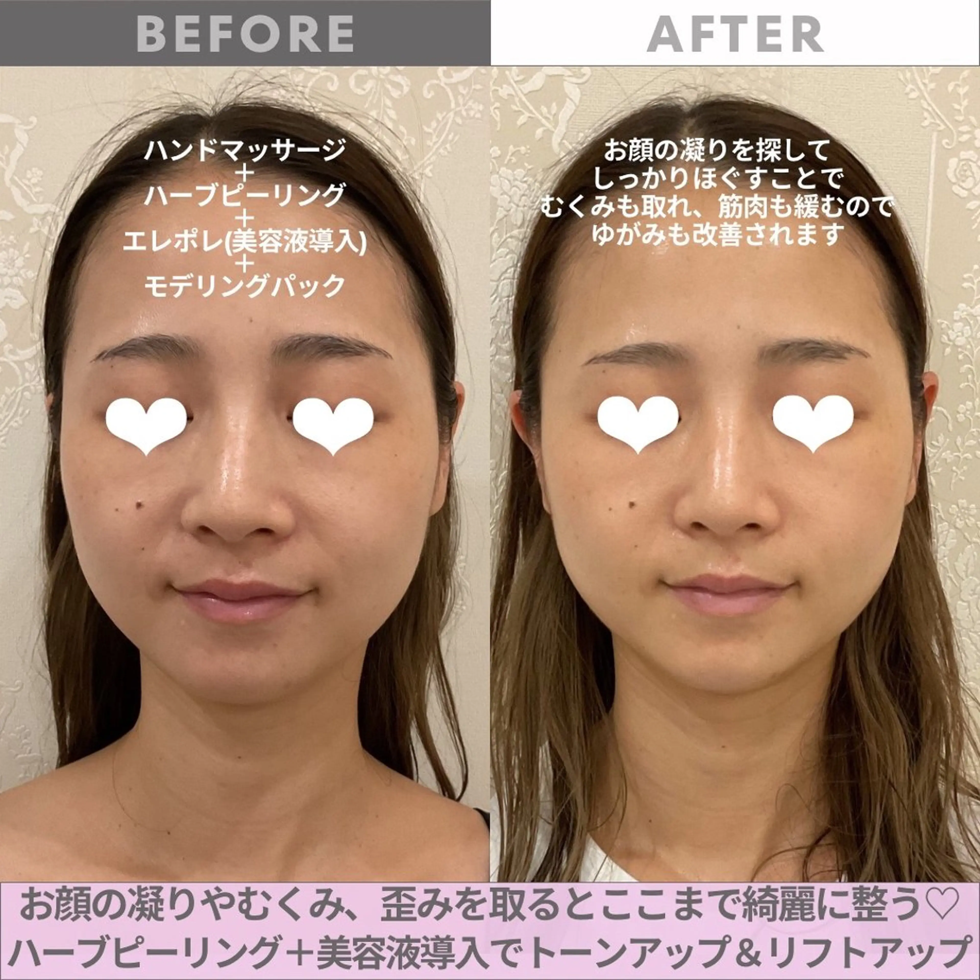 エステ リンデザ 山口のエステ・リラクイメージ