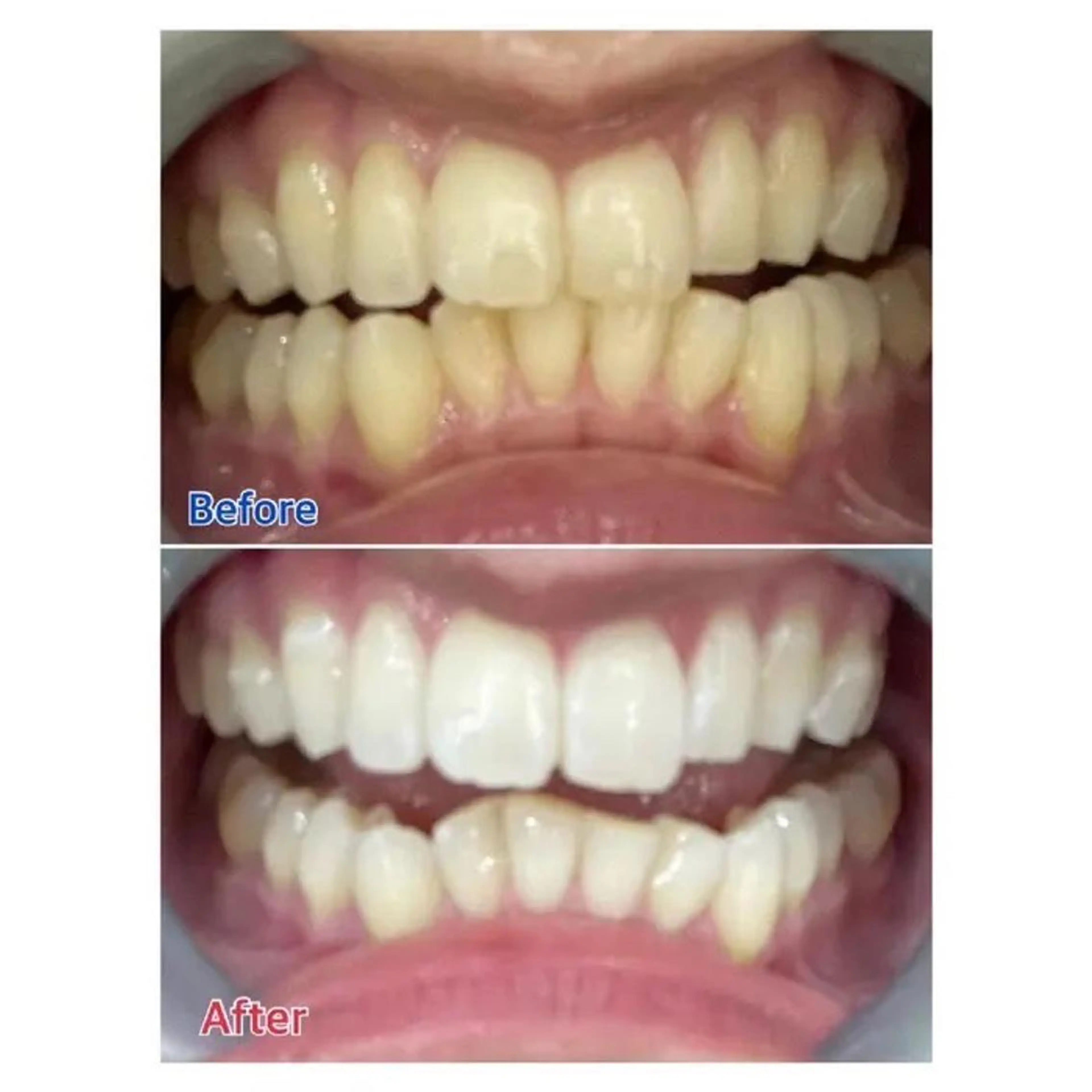 M渋谷 ホワイトニングのエステ・リラクイメージ