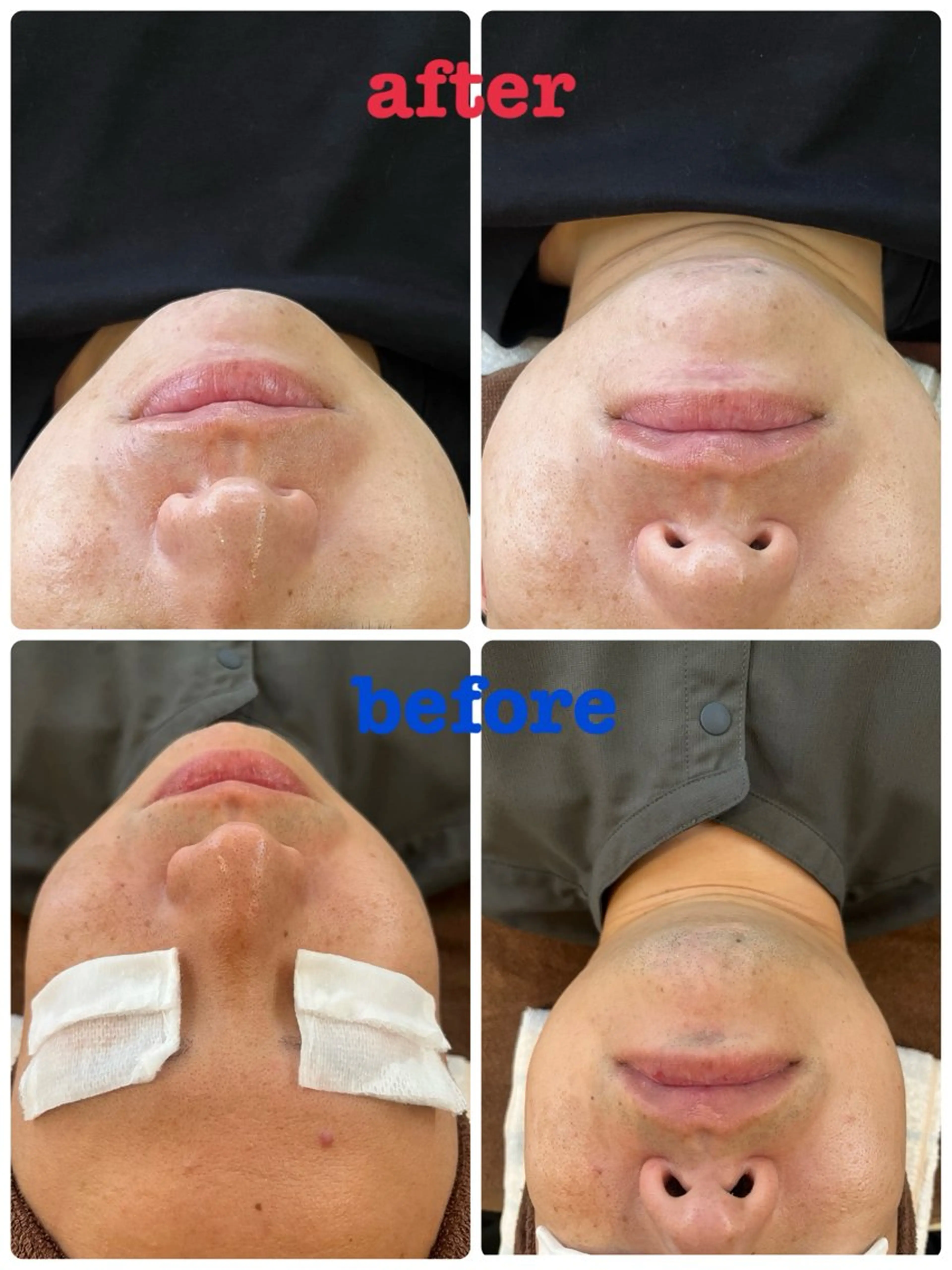 🌺痩身・育乳・ 脱毛ｻﾛﾝ/ｺｵﾘﾅのエステ・リラクイメージ