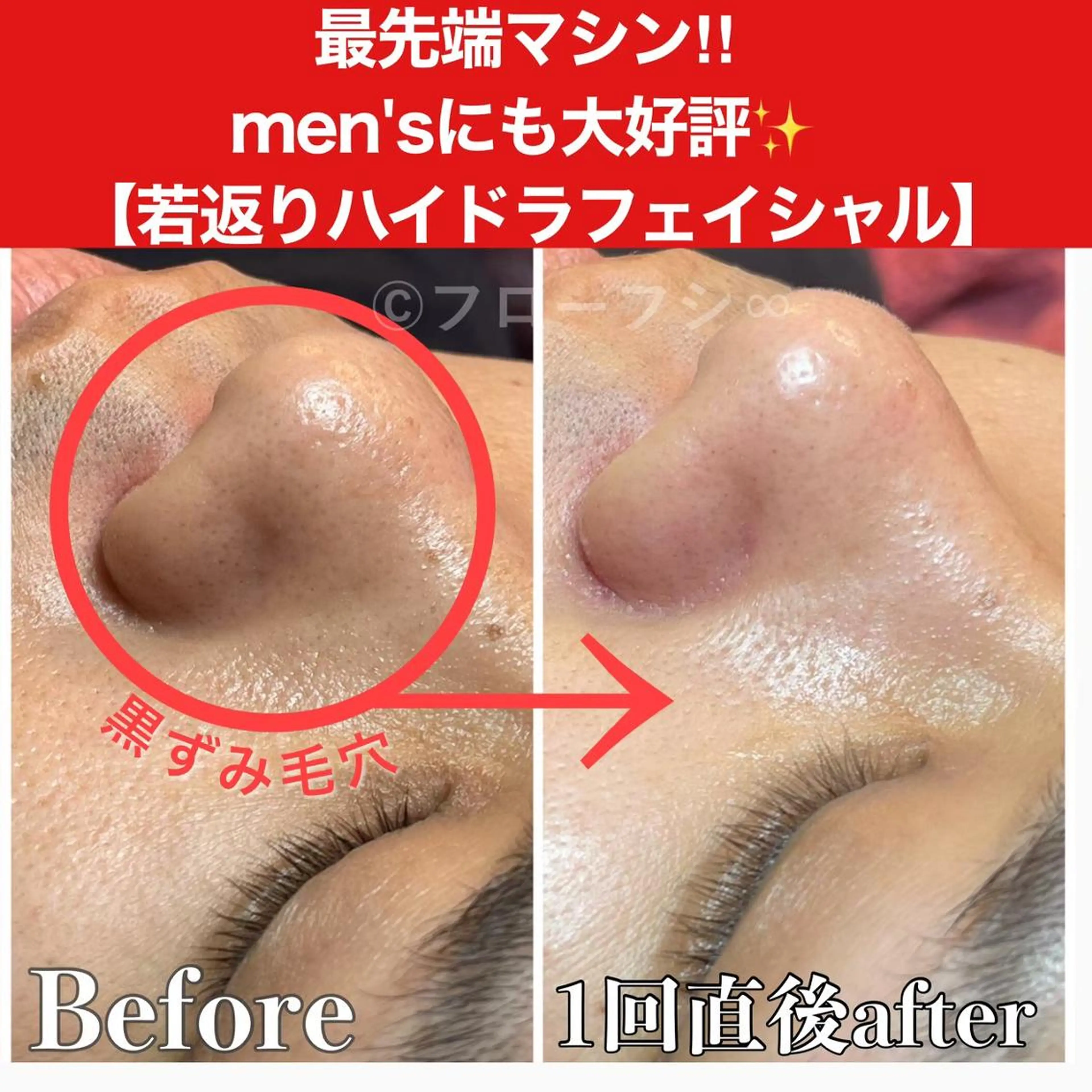 部分痩せ♥️小顔専門 MIKUのエステ・リラクイメージ