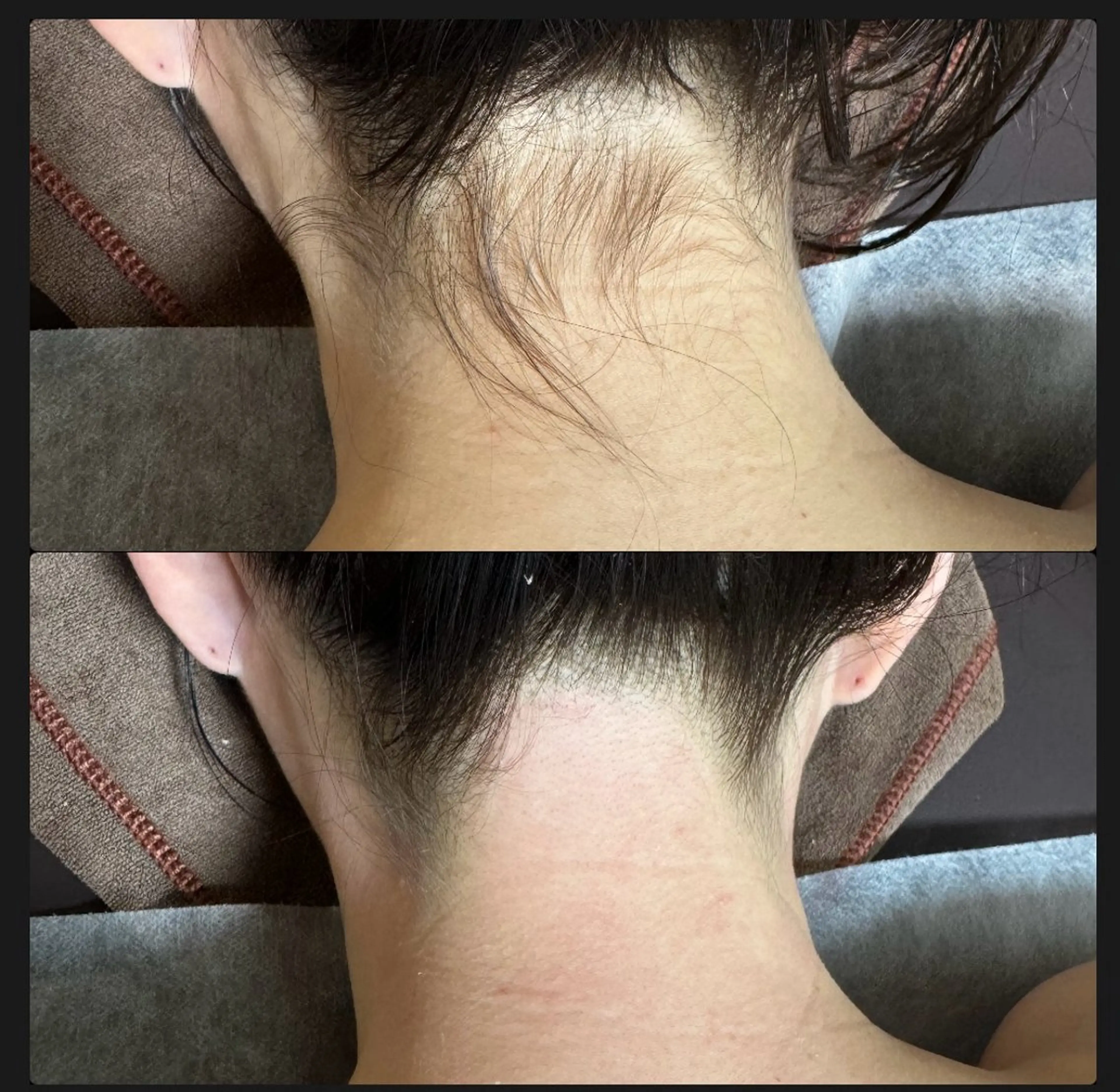 脱毛 六本木脱毛andS 店長Sachiのエステ・リラクイメージ