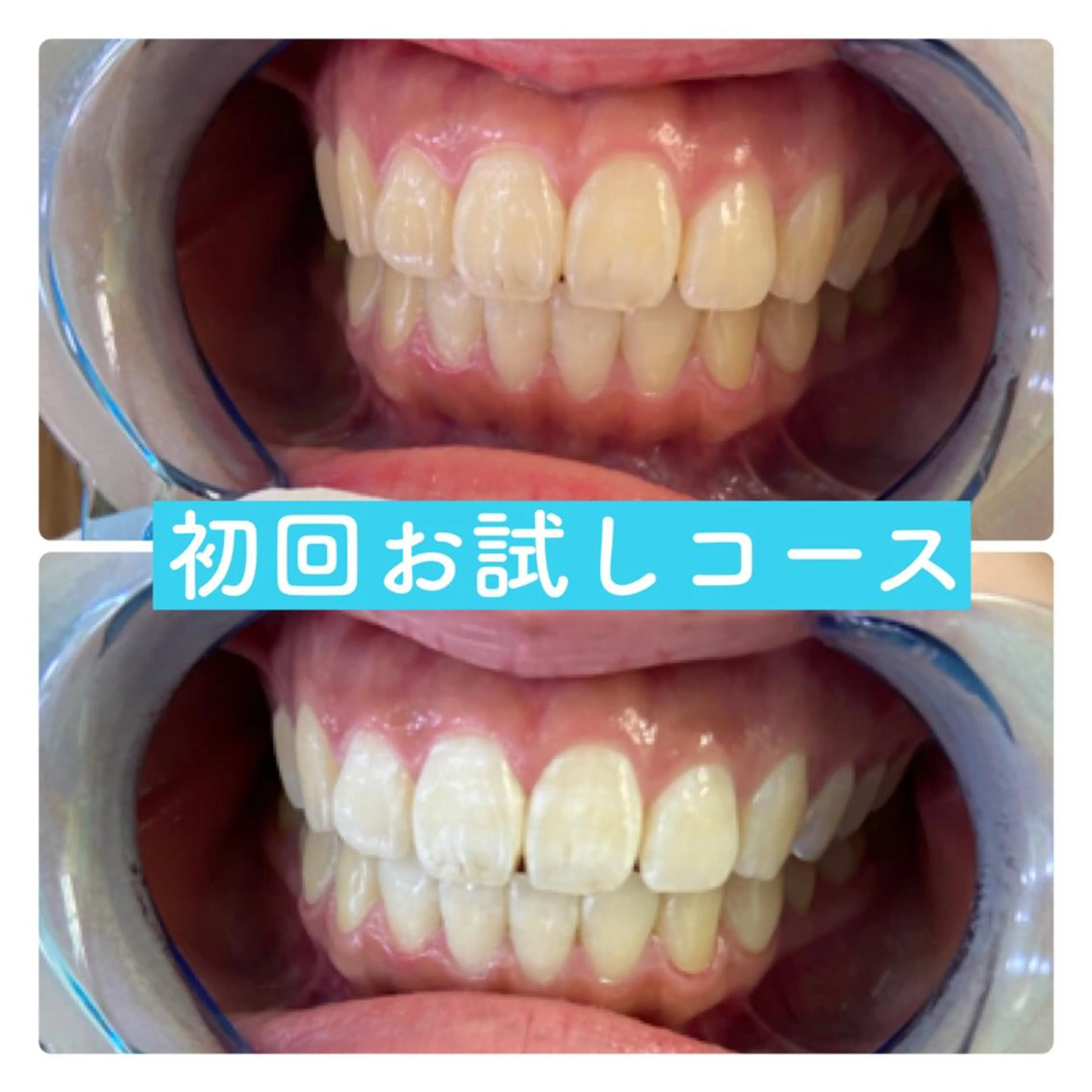 ホワイトニングルーム 横浜店のその他イメージ