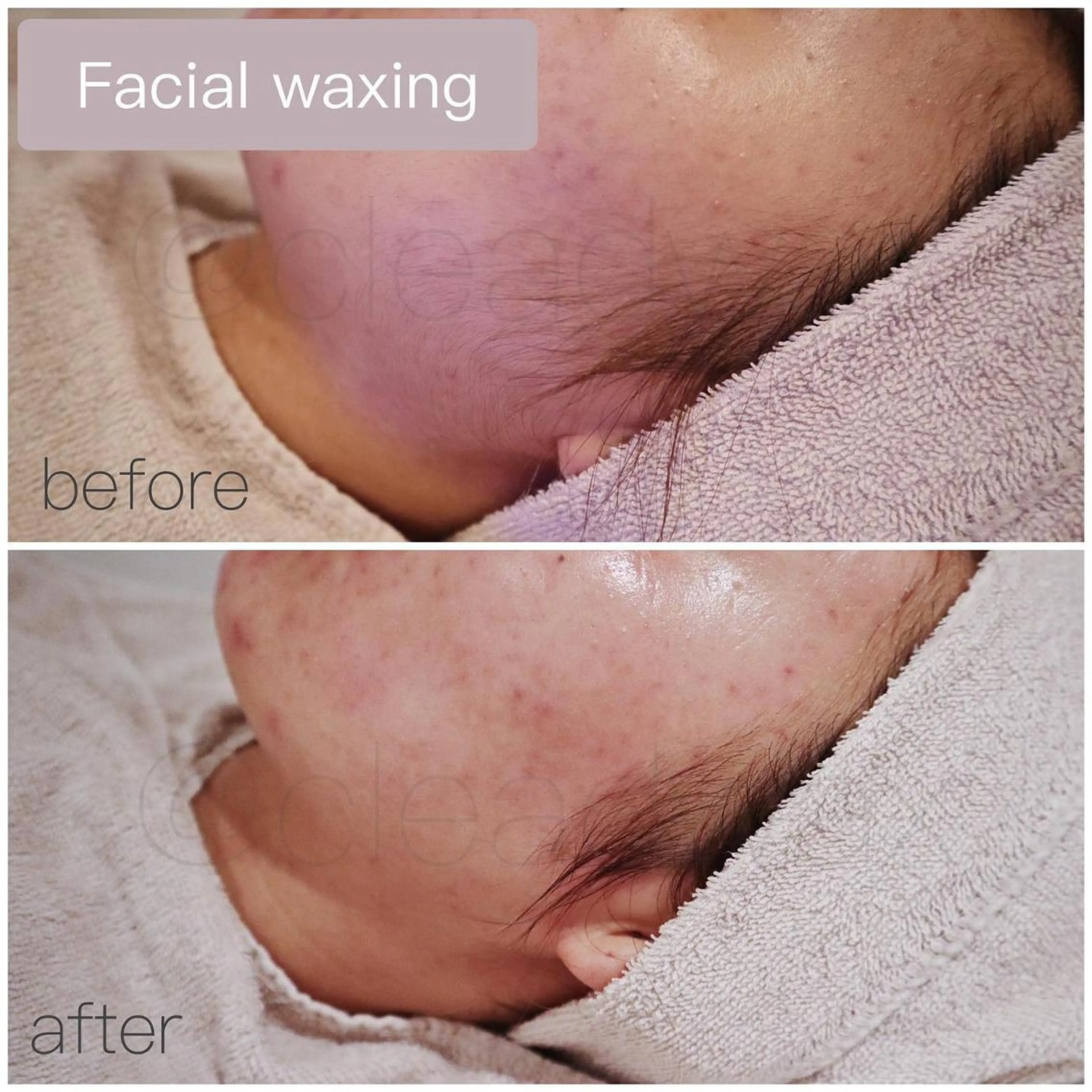 CLEAD 赤坂のエステ・リラクイメージ