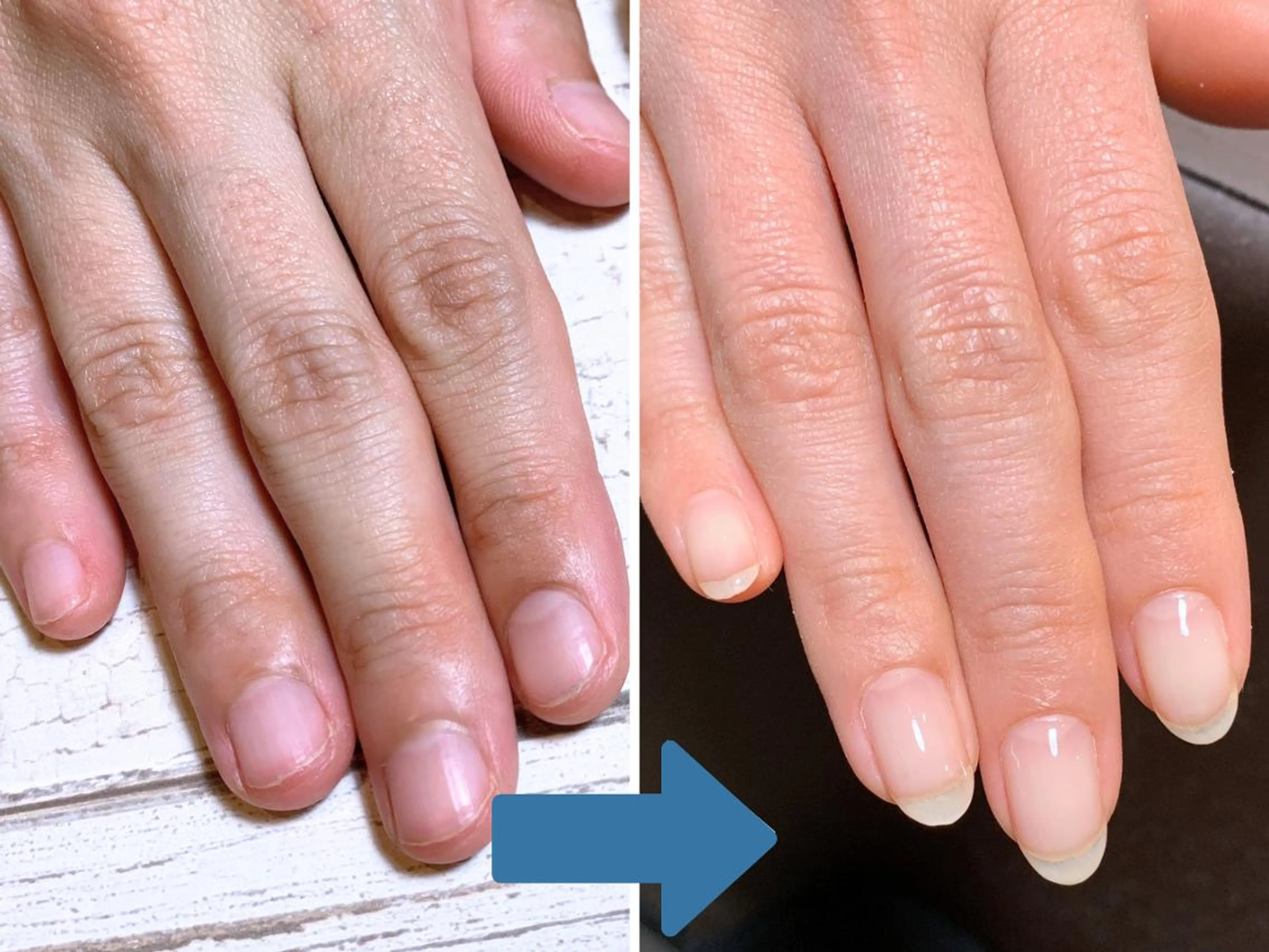 ネイル 深爪矯正・自爪育成 ネイルサロンアモまいのネイルデザイン