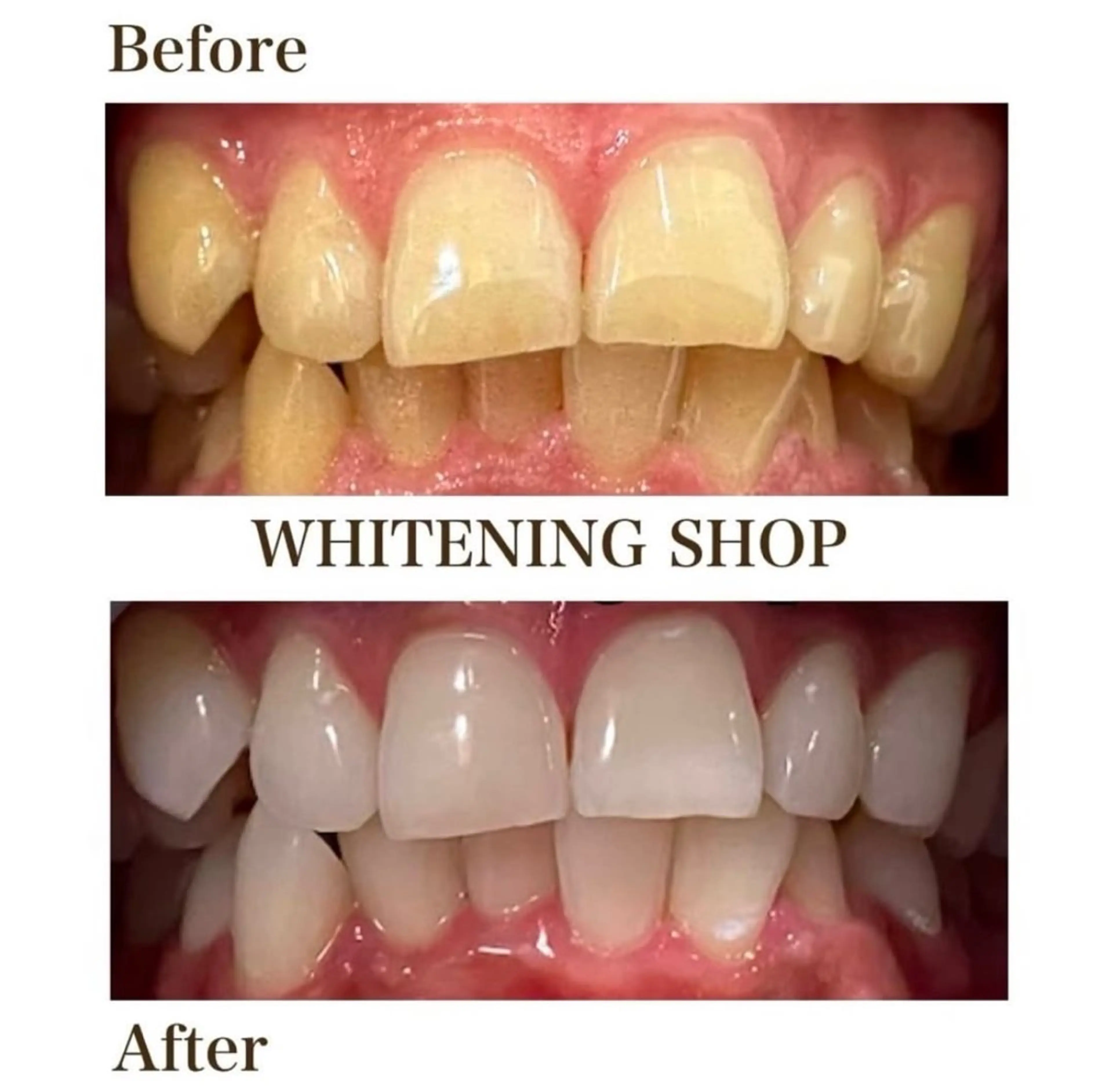 ホワイトニング ショップ伊丹店のその他イメージ