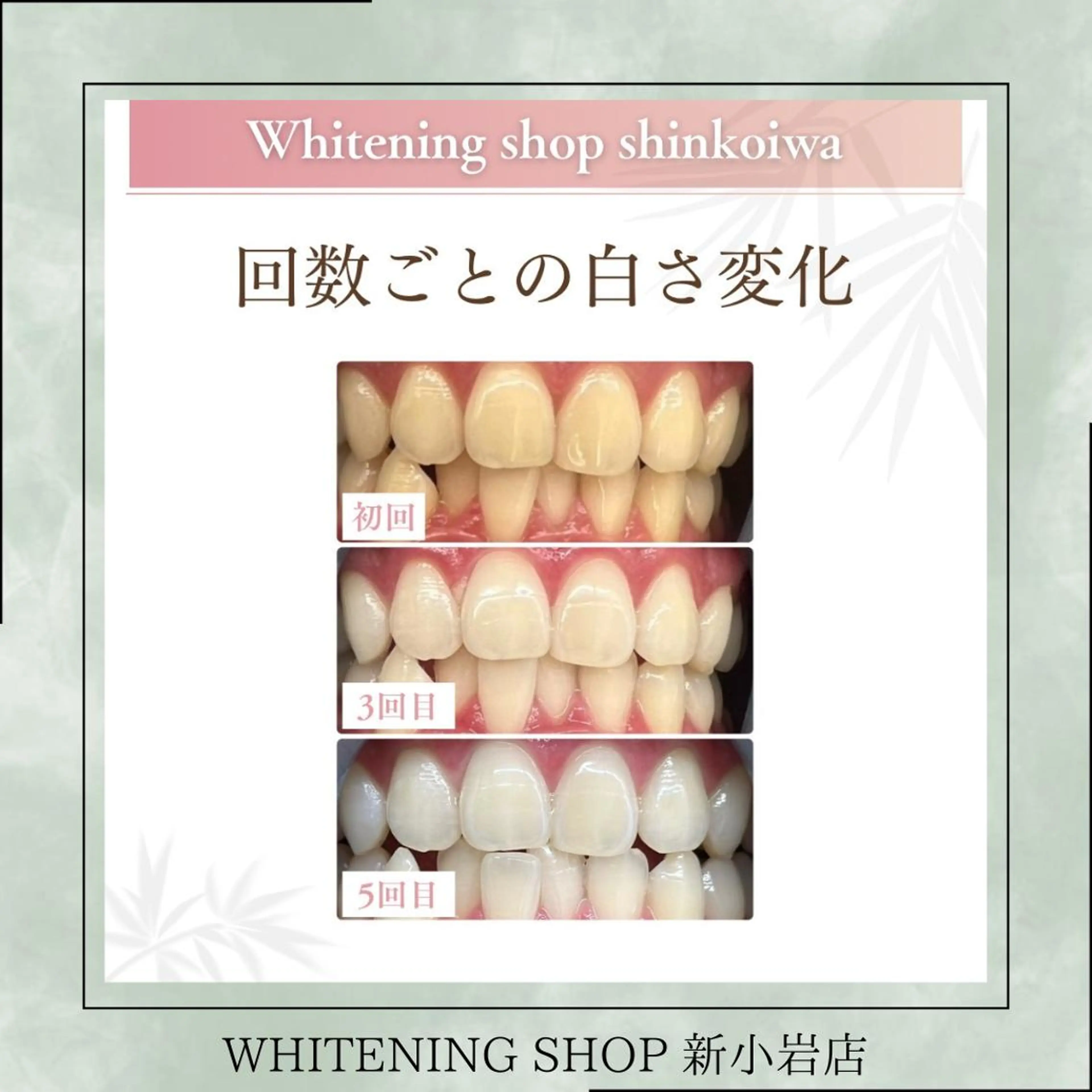 メンズ その他 ホワイトニング ショップ新小岩店のその他イメージ